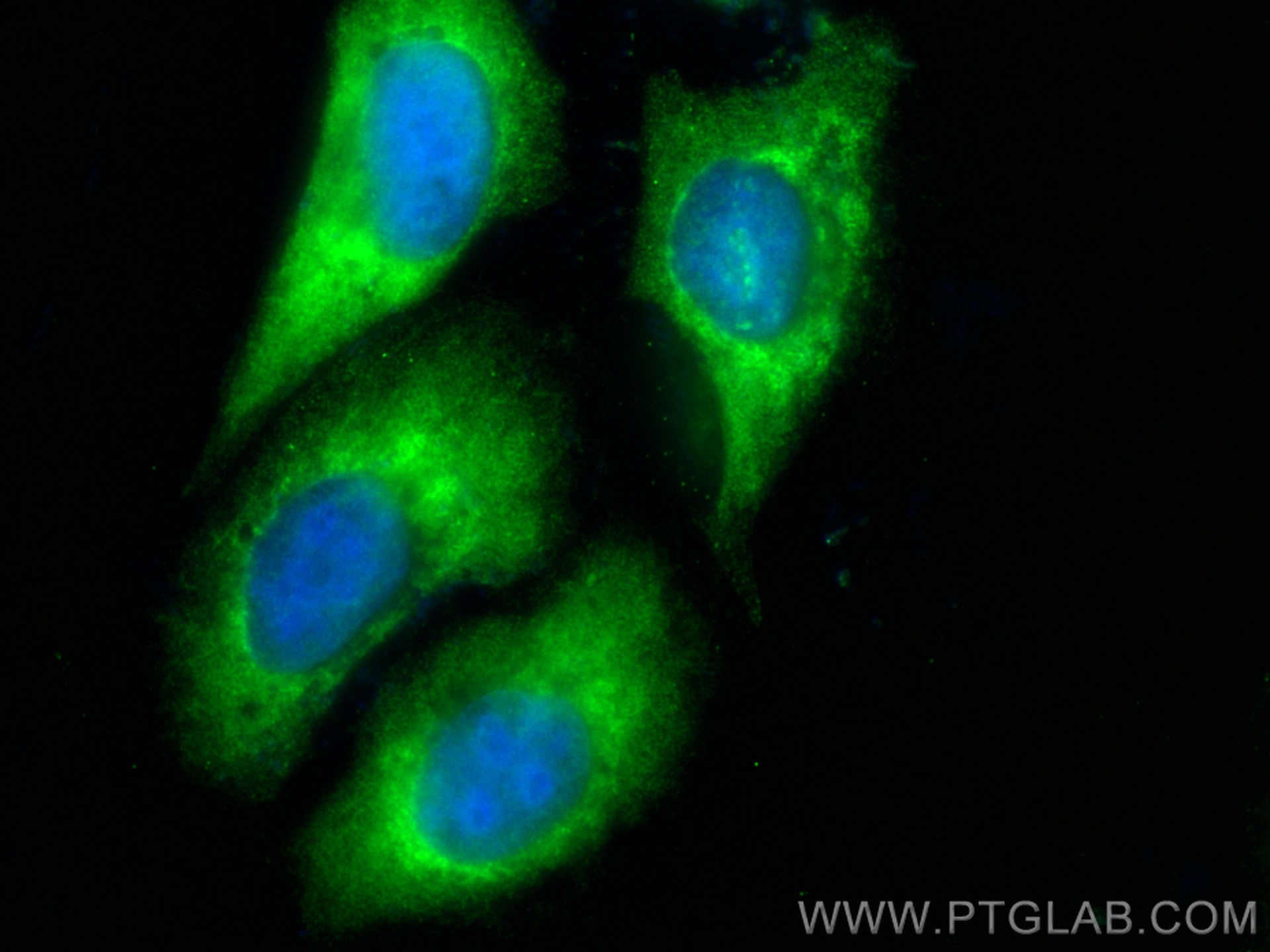 Immunofluorescence (IF) / fluorescent staining of U2OS cells using CoraLite® Plus 488-conjugated MAN1B1 Monoclonal an (CL488-68121)