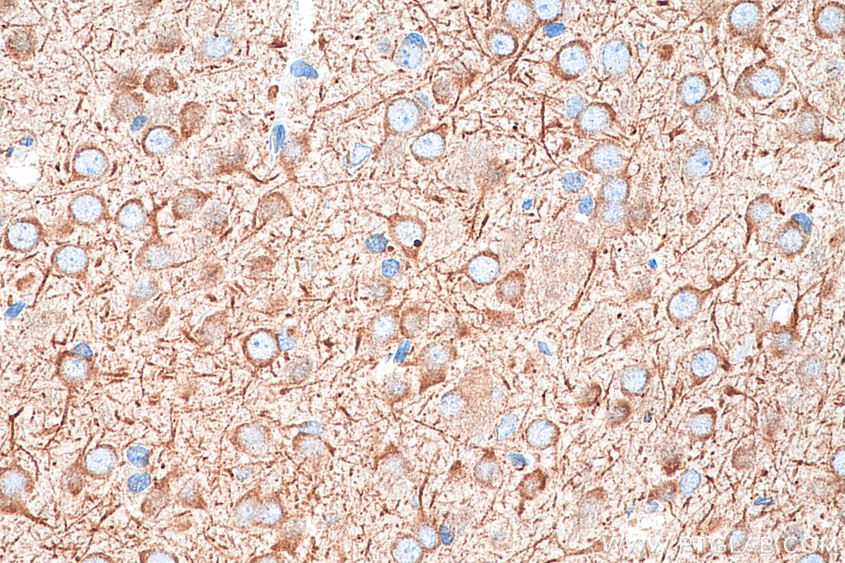 Immunohistochemistry (IHC) staining of rat brain tissue using MAP1A Polyclonal antibody (55062-1-AP)