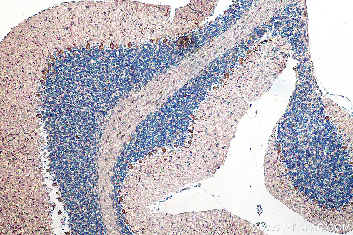 Immunohistochemistry (IHC) staining of mouse cerebellum tissue using MAP1A Polyclonal antibody (55062-1-AP)