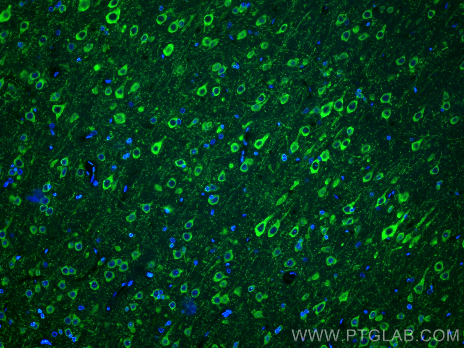 Immunofluorescence (IF) / fluorescent staining of rat brain tissue using CoraLite® Plus 488-conjugated MAP1B Monoclonal ant (CL488-67423)