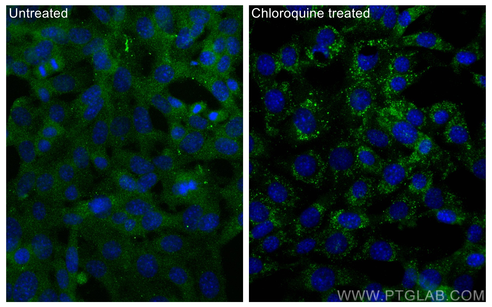 Immunofluorescence (IF) / fluorescent staining of NIH/3T3 cells using LC3 Monoclonal antibody (66139-3-Ig)