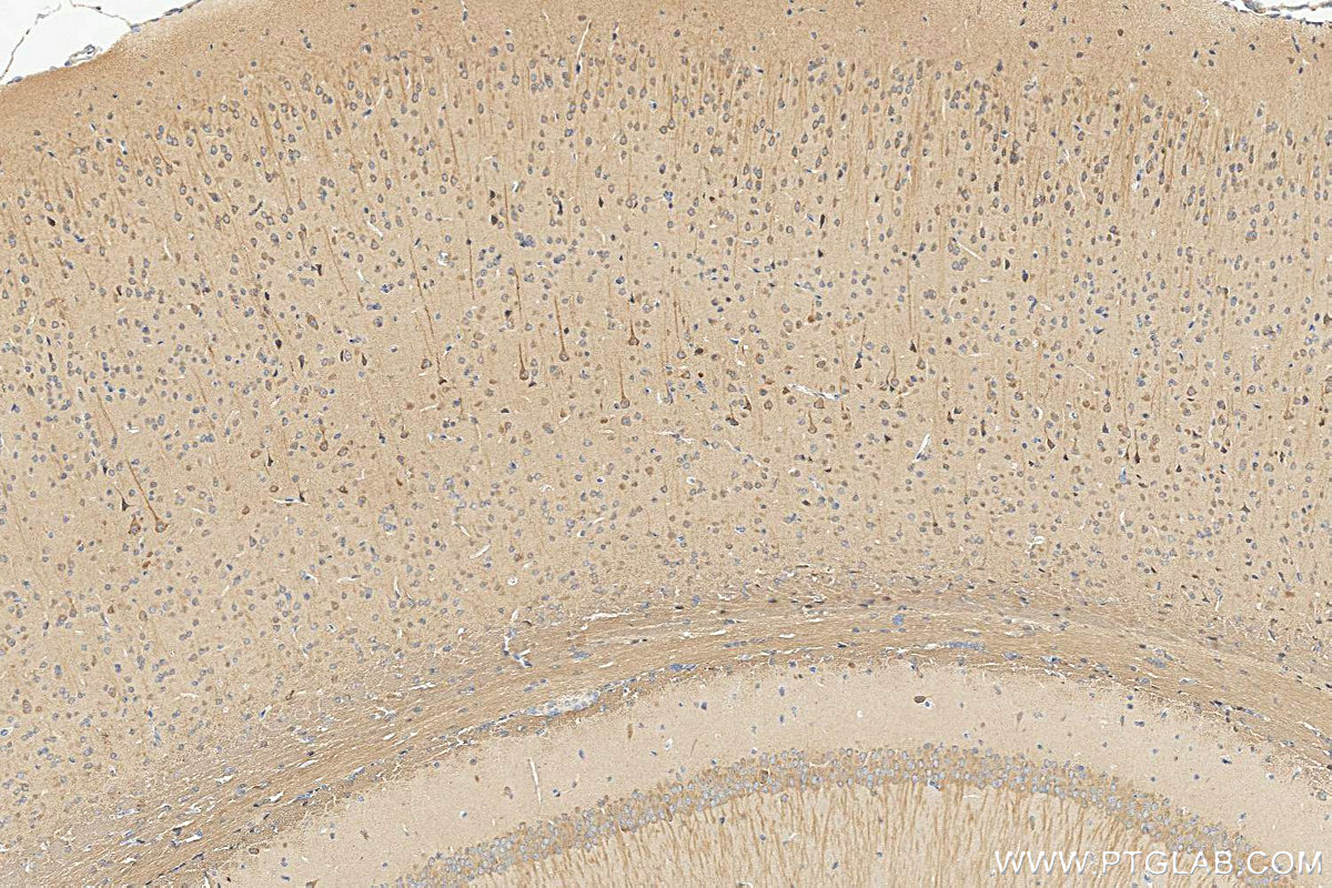 Immunohistochemistry (IHC) staining of mouse brain tissue using LC3 Polyclonal antibody (14600-1-AP)