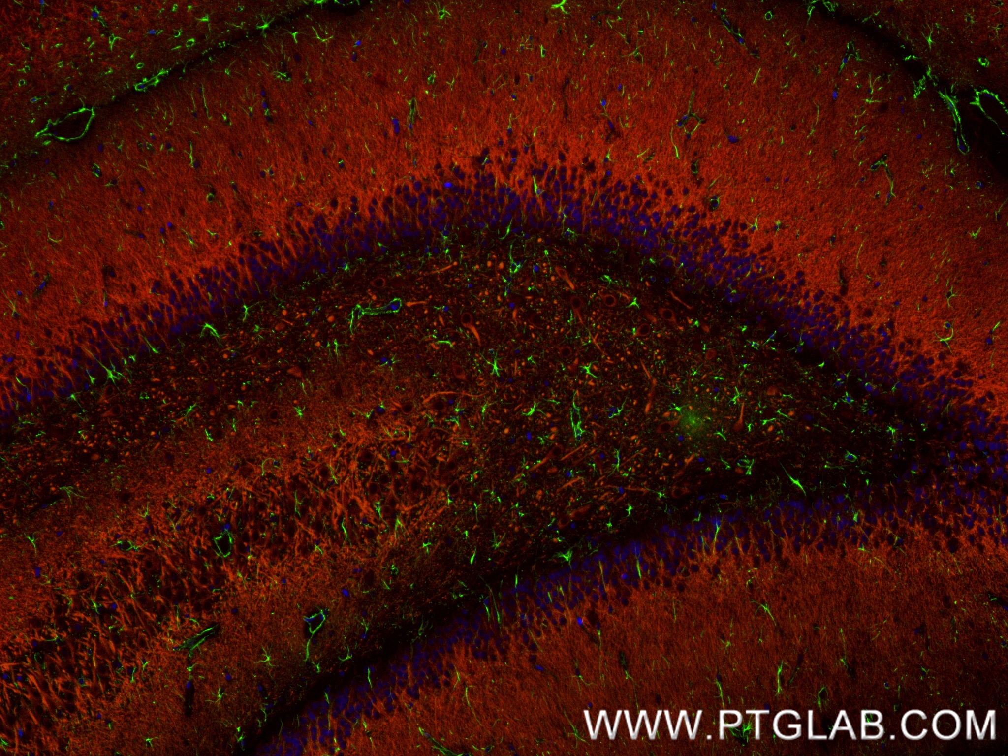 Immunofluorescence (IF) / fluorescent staining of rat brain tissue using MAP2 Recombinant antibody (84306-3-RR)