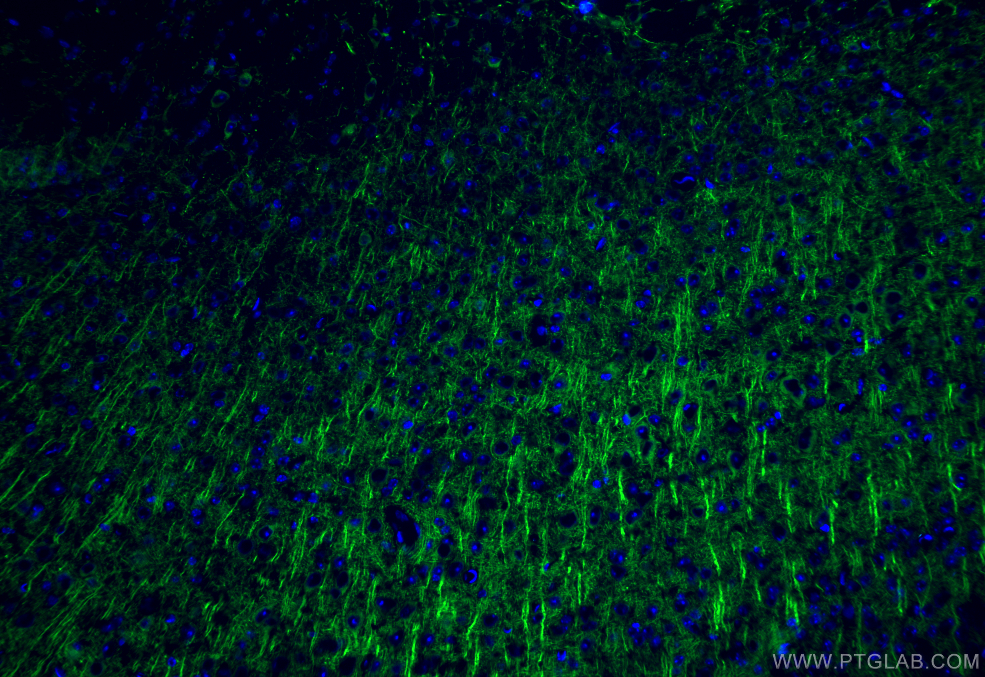 Immunofluorescence (IF) / fluorescent staining of mouse brain tissue using MAP2 Recombinant antibody (84306-3-RR)