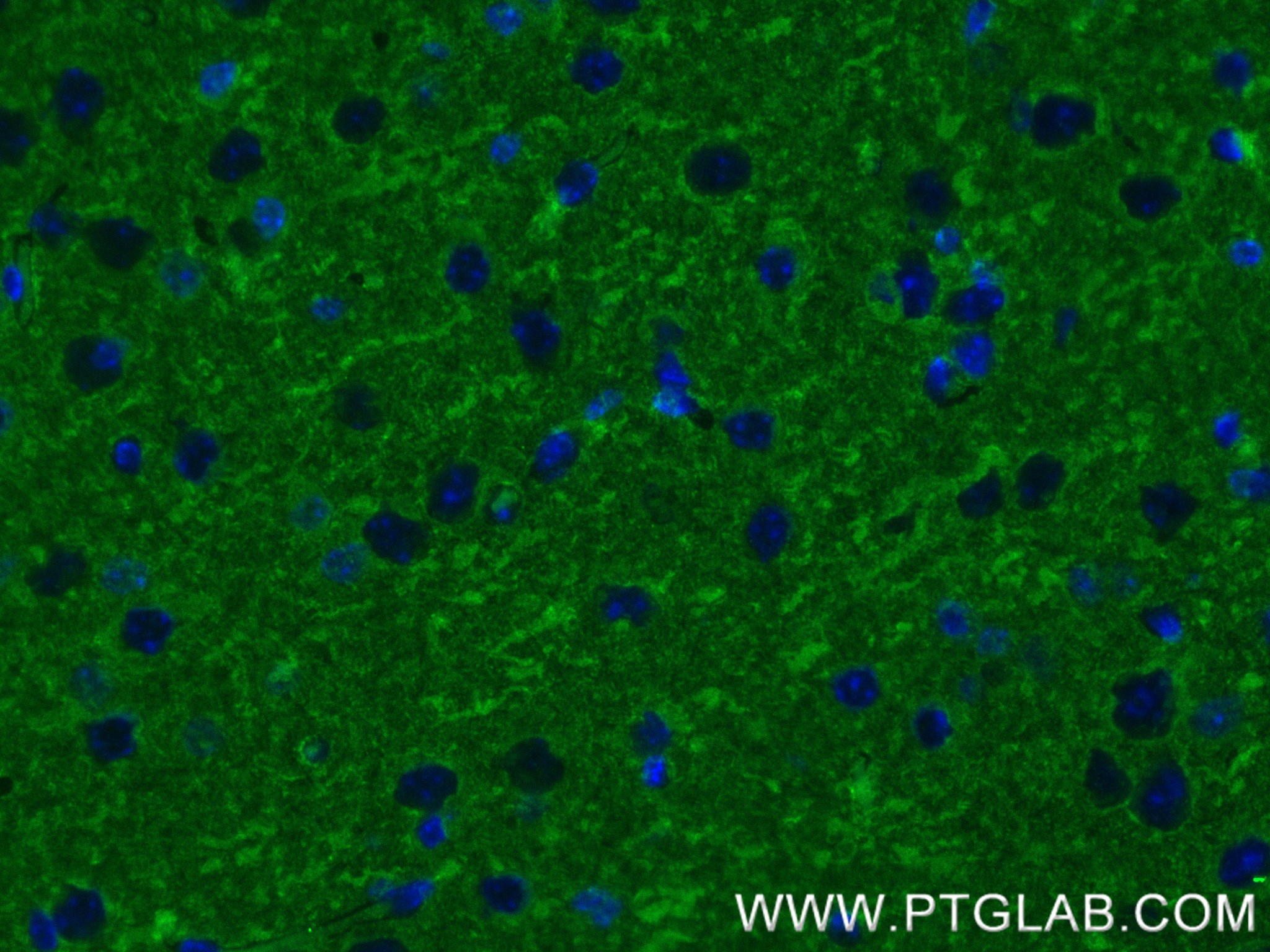 Immunofluorescence (IF) / fluorescent staining of mouse brain tissue using MAP2 Recombinant antibody (84306-4-RR)