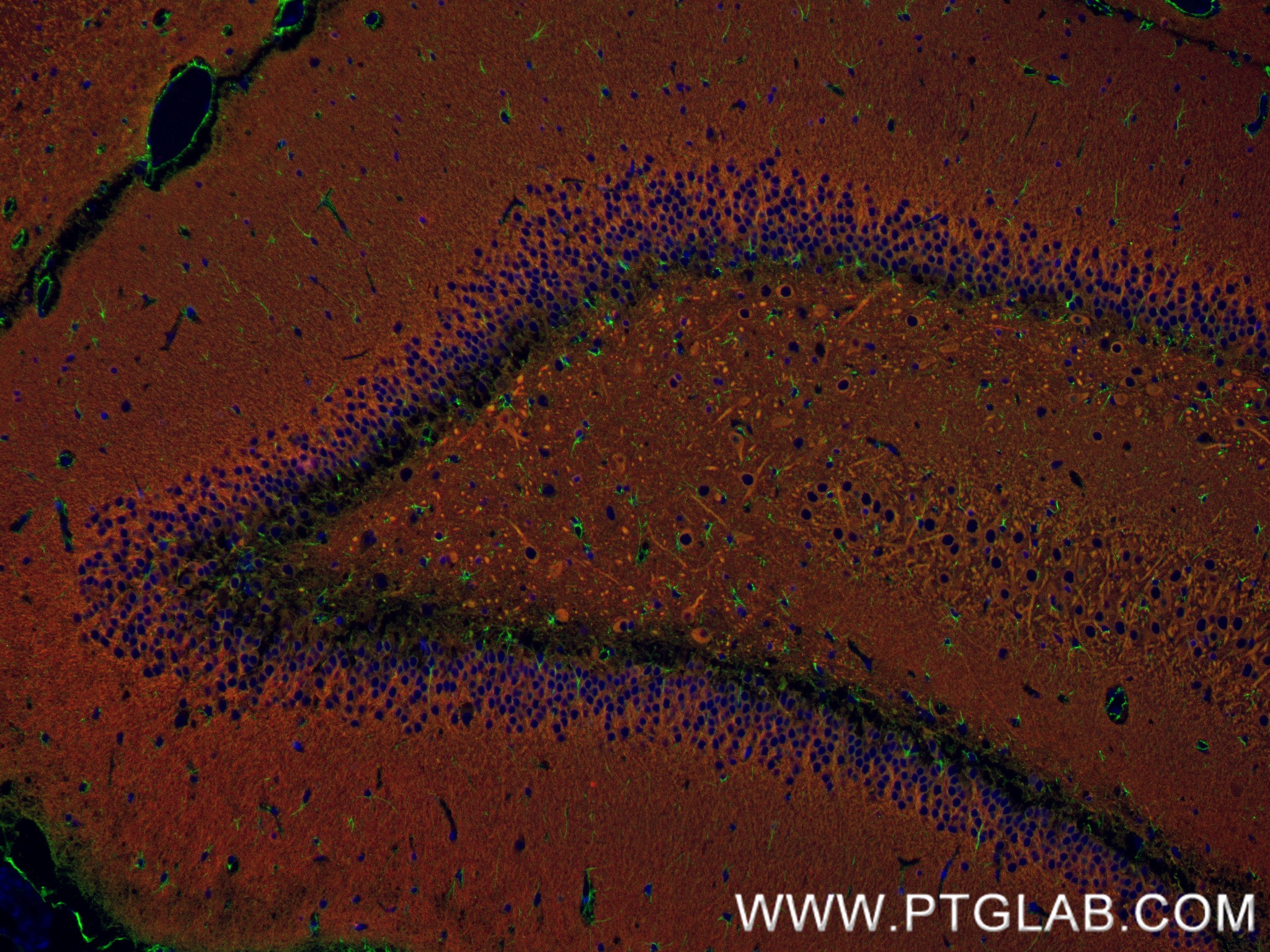 Immunofluorescence (IF) / fluorescent staining of rat brain tissue using MAP2 Recombinant antibody (84306-4-RR)