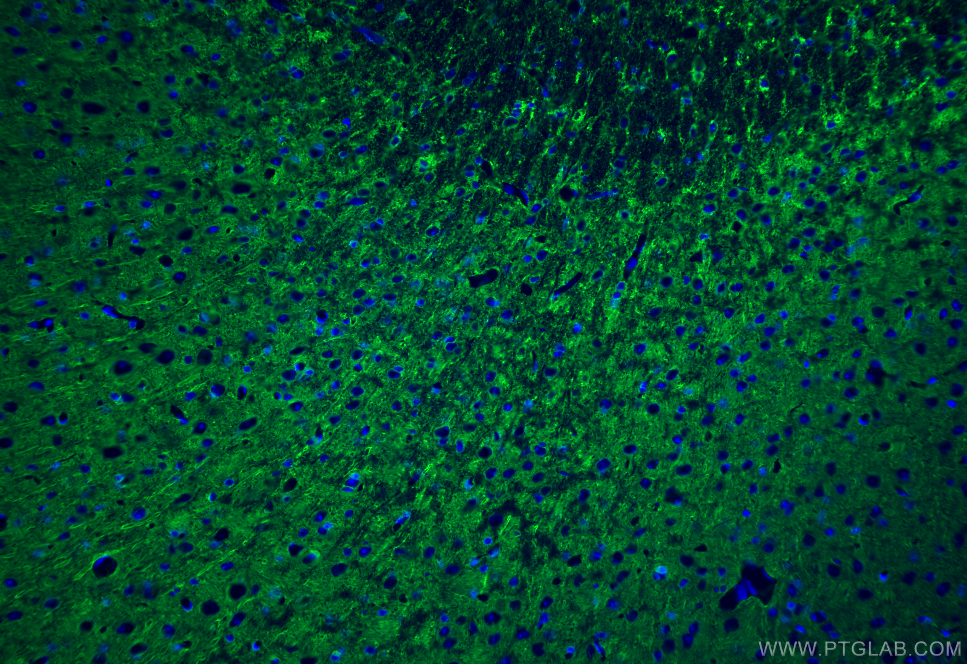 Immunofluorescence (IF) / fluorescent staining of mouse brain tissue using MAP2 Recombinant antibody (84306-4-RR)