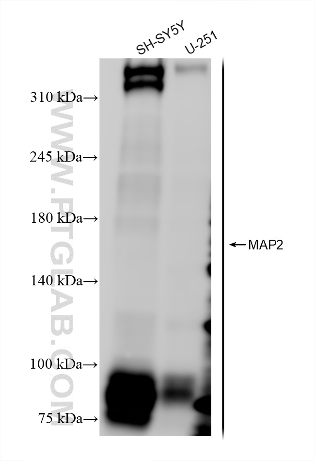 Western Blot (WB) analysis of various lysates using MAP2 Recombinant antibody (84306-4-RR)