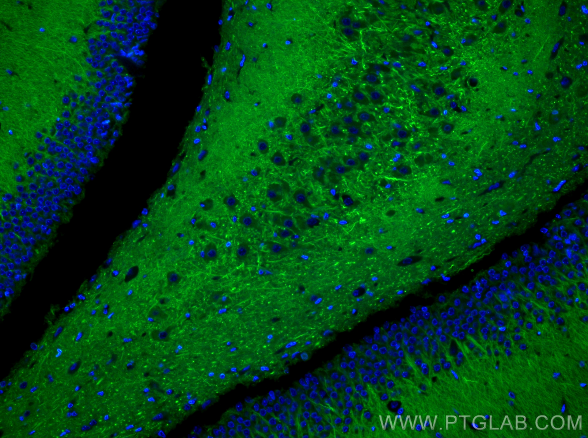 Immunofluorescence (IF) / fluorescent staining of rat brain tissue using CoraLite® Plus 488-conjugated MAP2 Recombinant ant (CL488-84306-4)