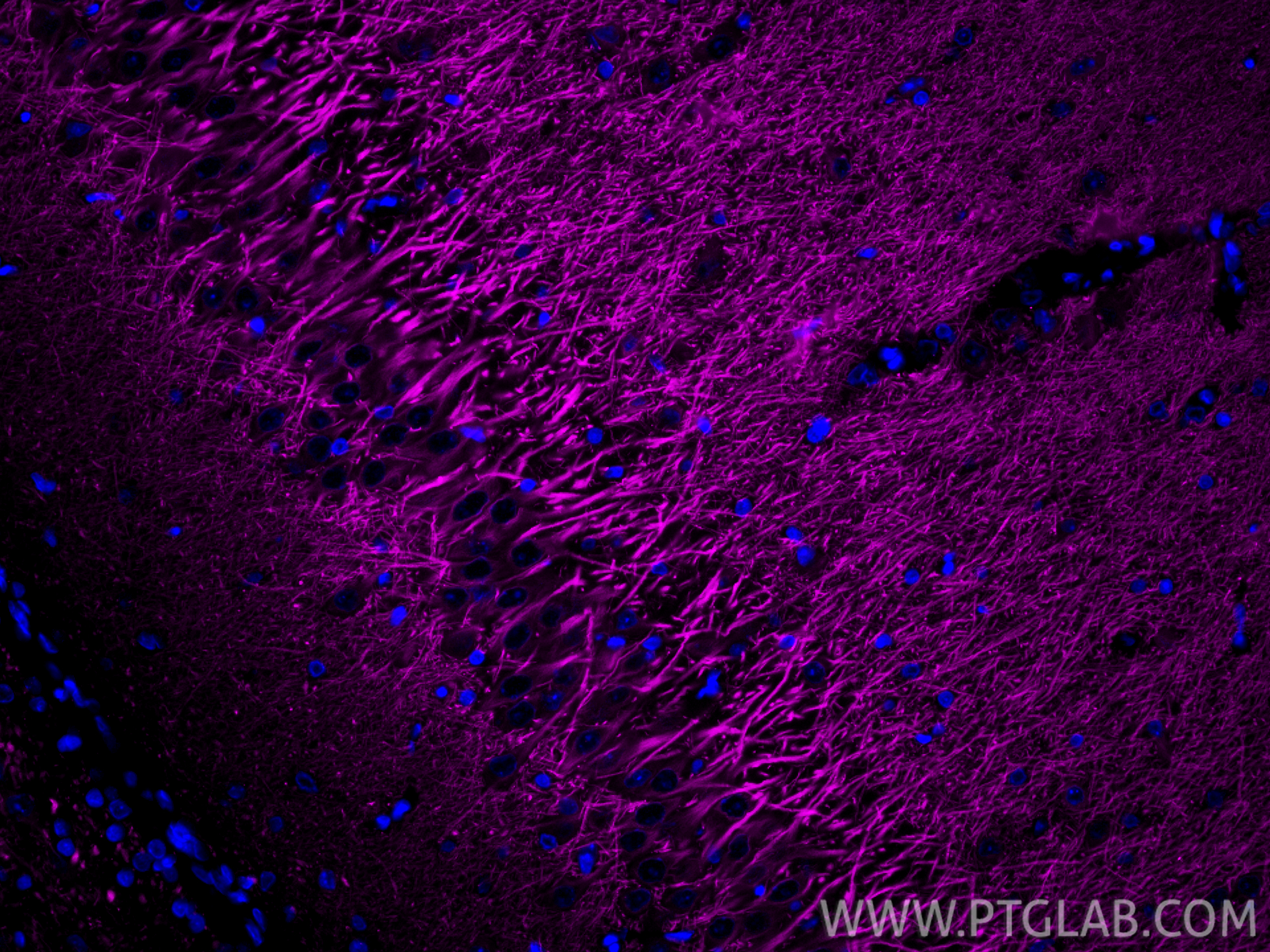 Immunofluorescence (IF) / fluorescent staining of rat brain tissue using CoraLite® Plus 647-conjugated MAP2 Recombinant ant (CL647-84306-3)