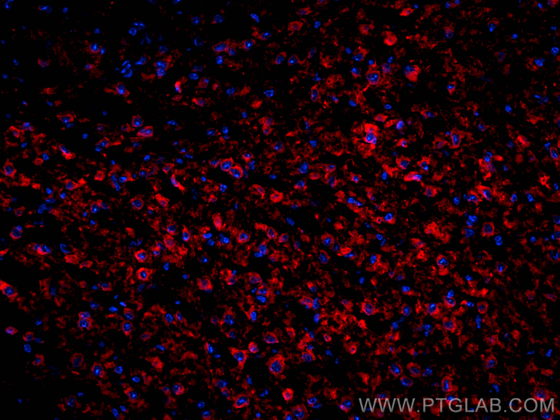 Immunofluorescence (IF) / fluorescent staining of mouse brain tissue using MAP2 Polyclonal antibody (17490-1-AP)