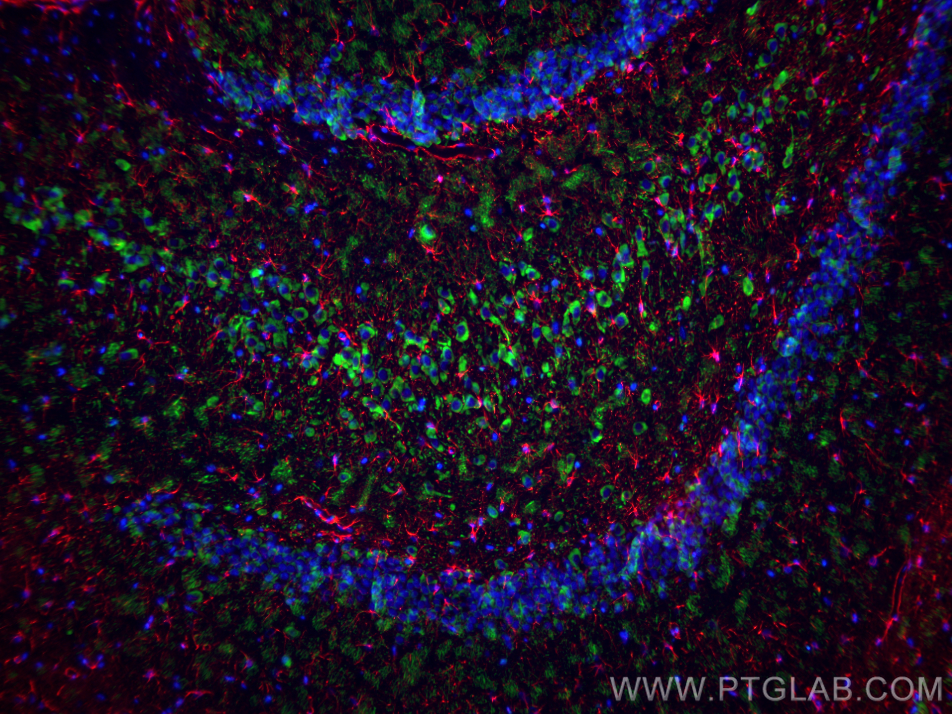 Immunofluorescence (IF) / fluorescent staining of rat brain tissue using MAP2 Polyclonal antibody (17490-1-AP)