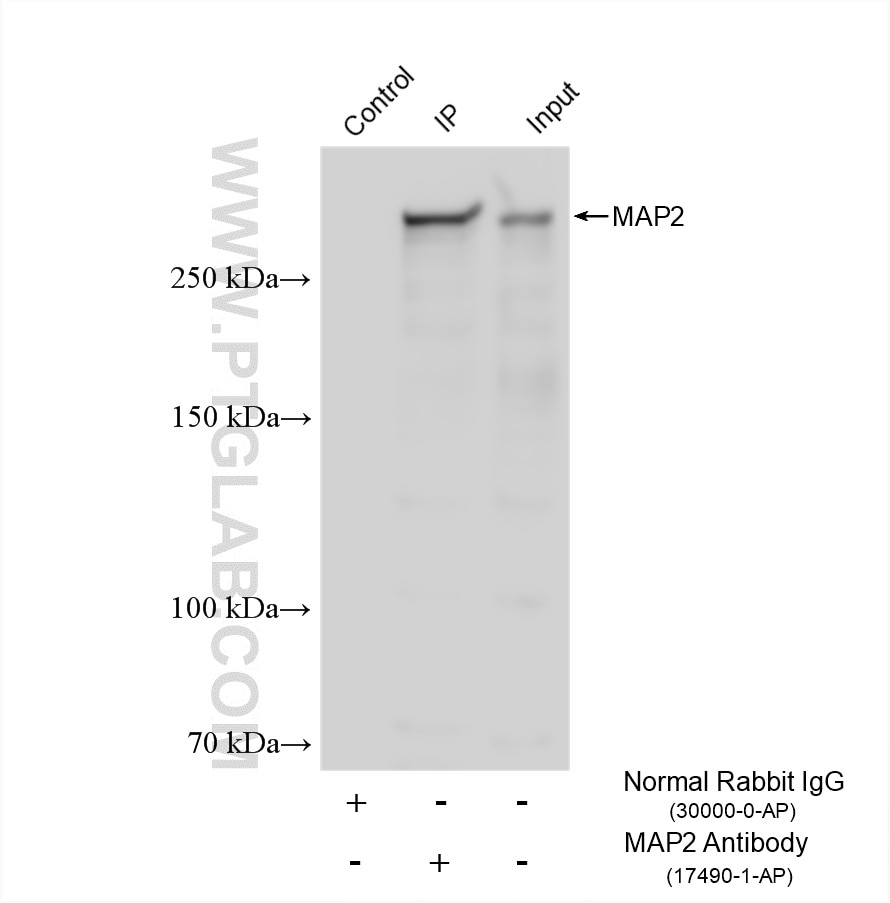 Immunoprecipitation (IP) experiment of mouse brain tissue using MAP2 Polyclonal antibody (17490-1-AP)