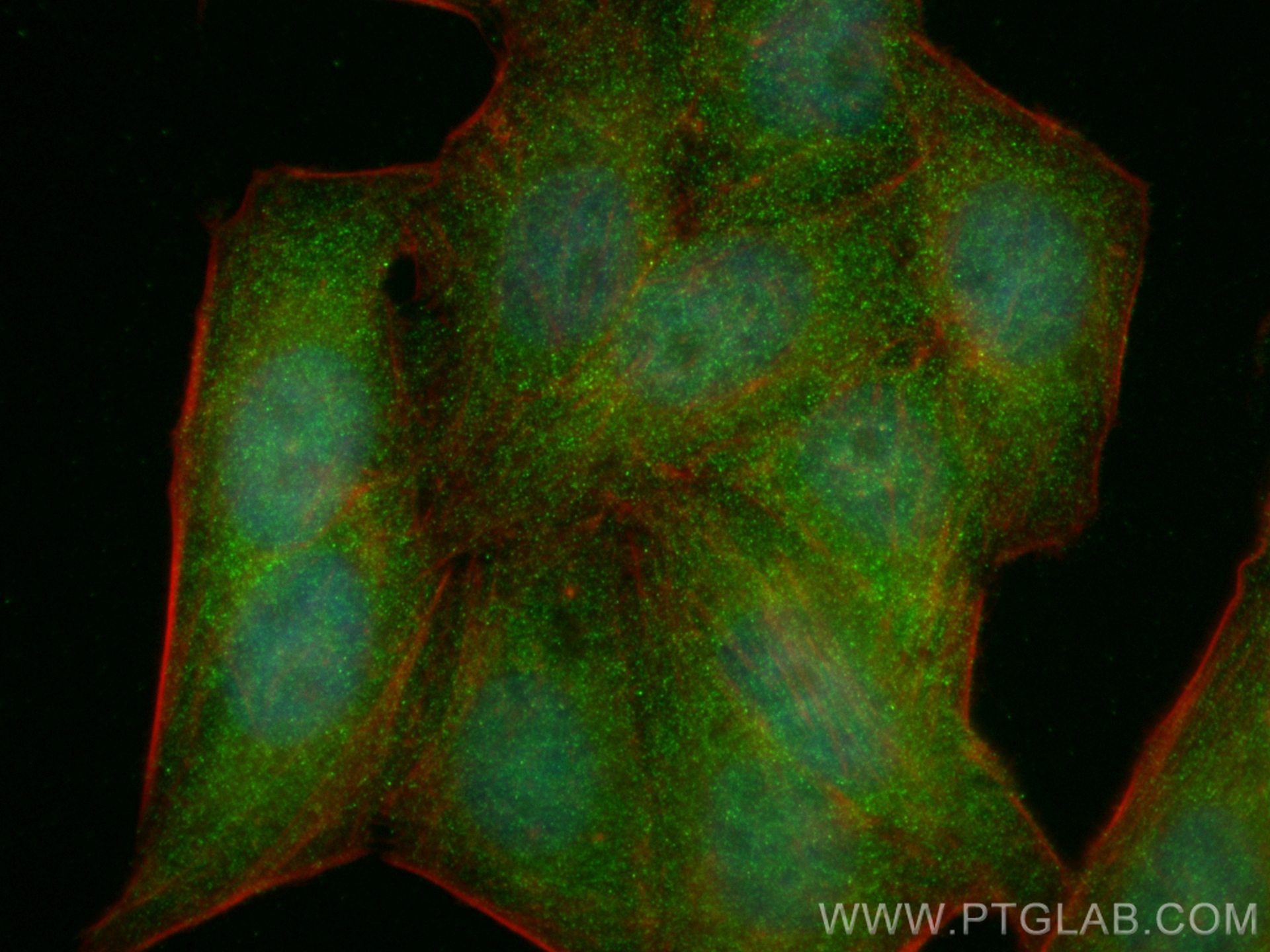 Immunofluorescence (IF) / fluorescent staining of HepG2 cells using MAP2K4 Monoclonal antibody (67333-1-Ig)