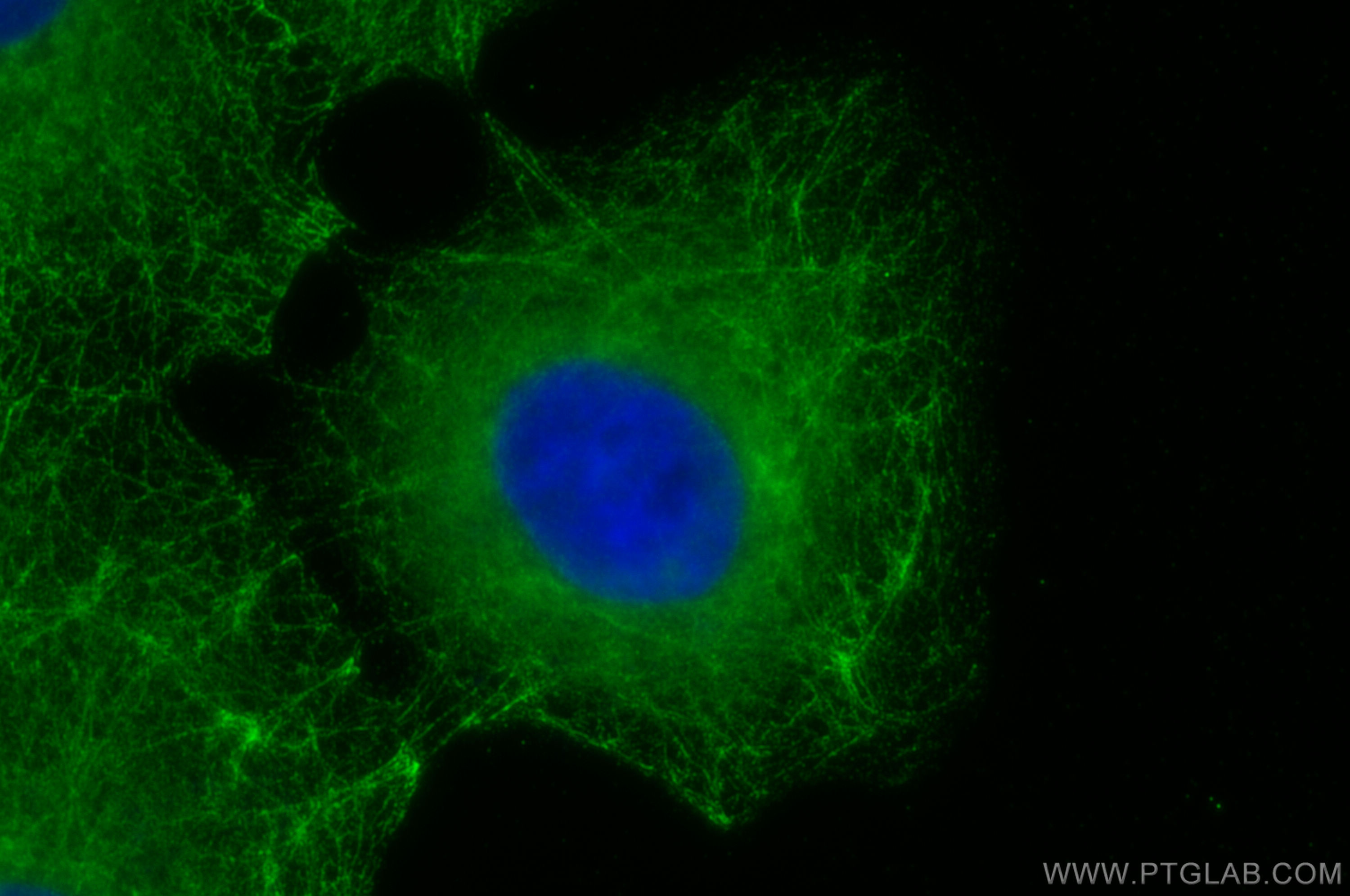 Immunofluorescence (IF) / fluorescent staining of A431 cells using MAP4 Monoclonal antibody (68271-1-Ig)