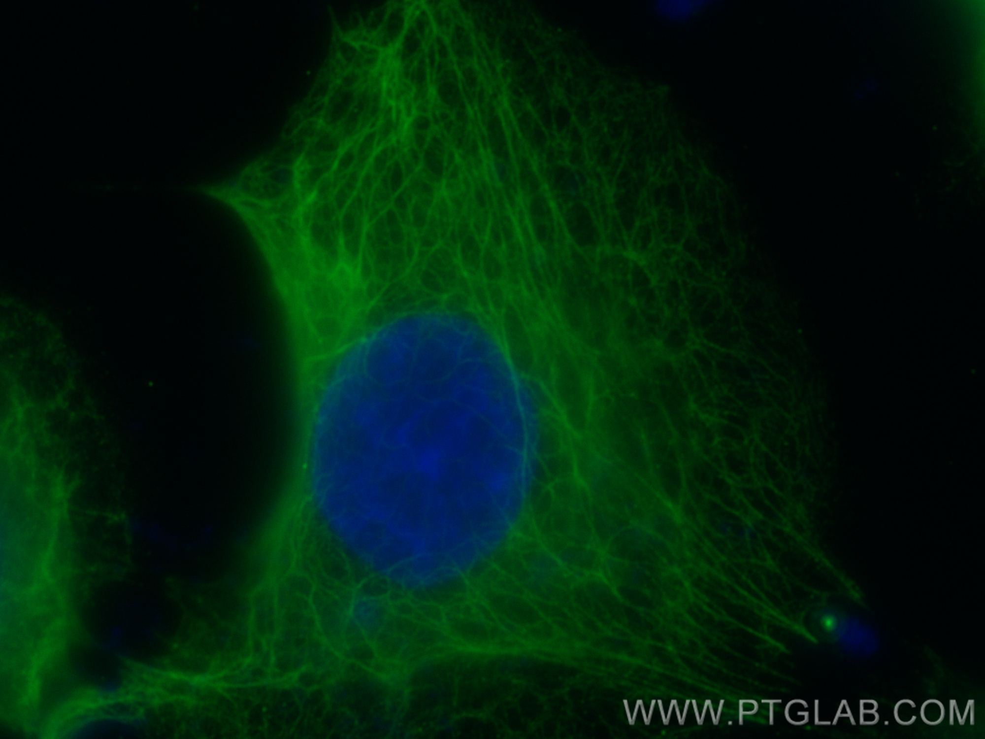 Immunofluorescence (IF) / fluorescent staining of A431 cells using CoraLite® Plus 488-conjugated MAP4 Monoclonal anti (CL488-68271)