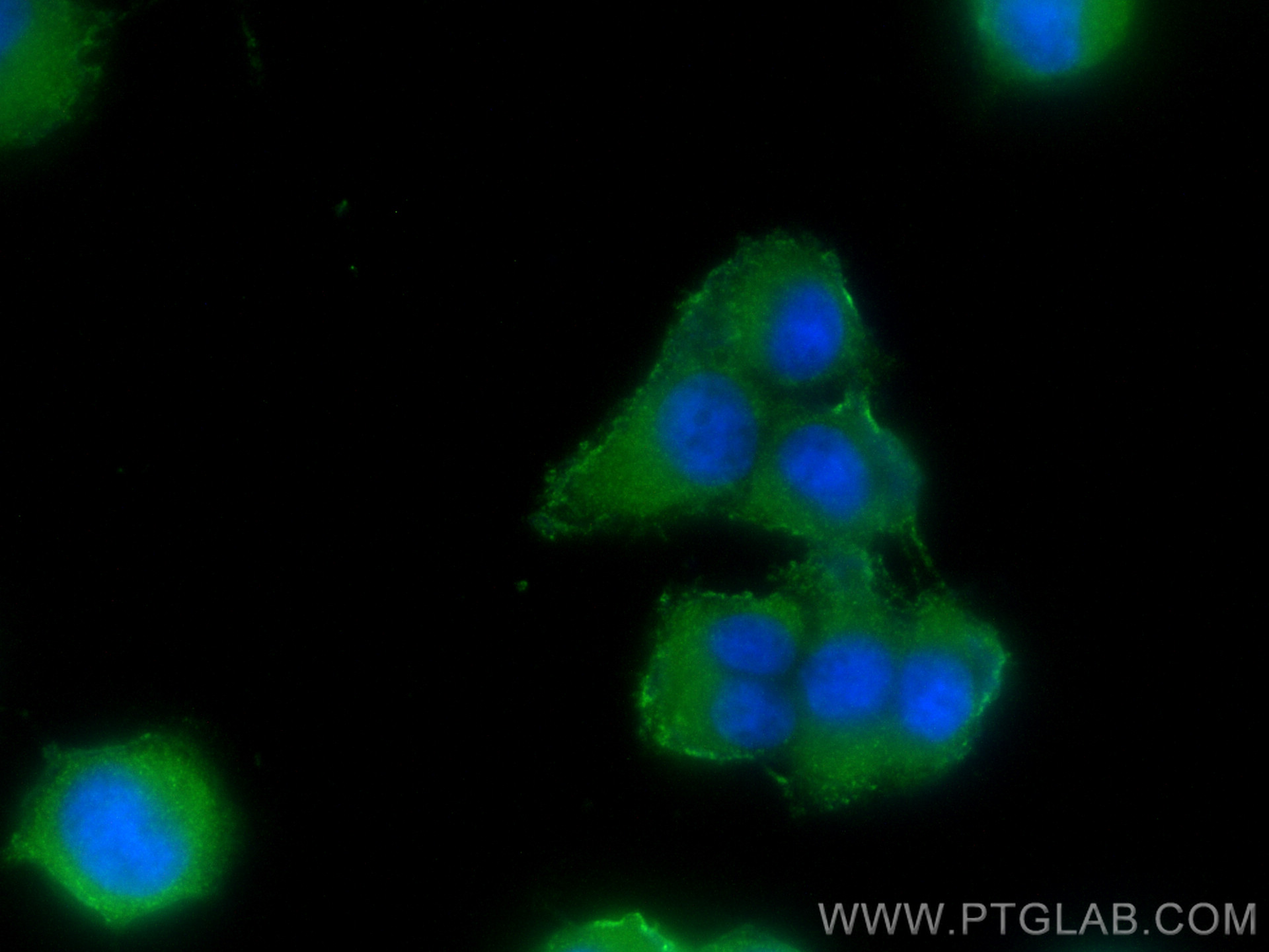 Immunofluorescence (IF) / fluorescent staining of PC-12 cells using MAP6/STOP Polyclonal antibody (25717-1-AP)