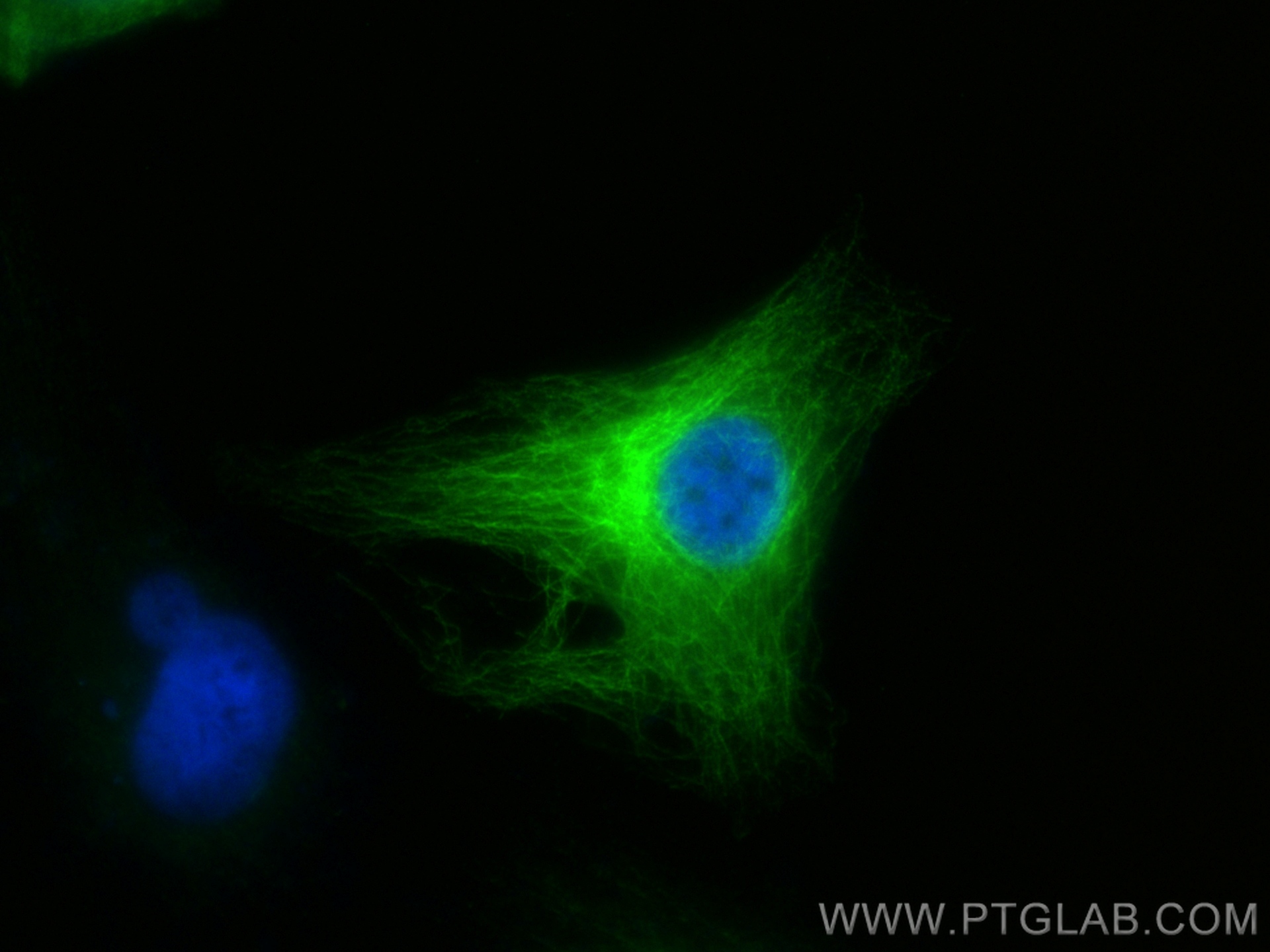 Immunofluorescence (IF) / fluorescent staining of HeLa cells using MAP7 Polyclonal antibody (13446-1-AP)