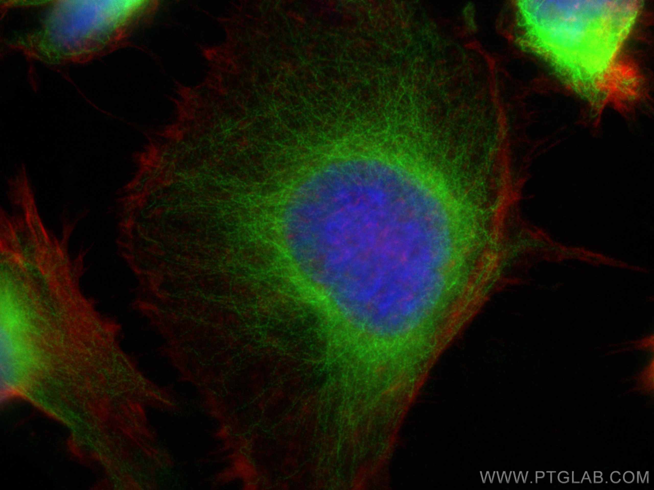 Immunofluorescence (IF) / fluorescent staining of U-251 cells using MAP7D1 Polyclonal antibody (20788-1-AP)