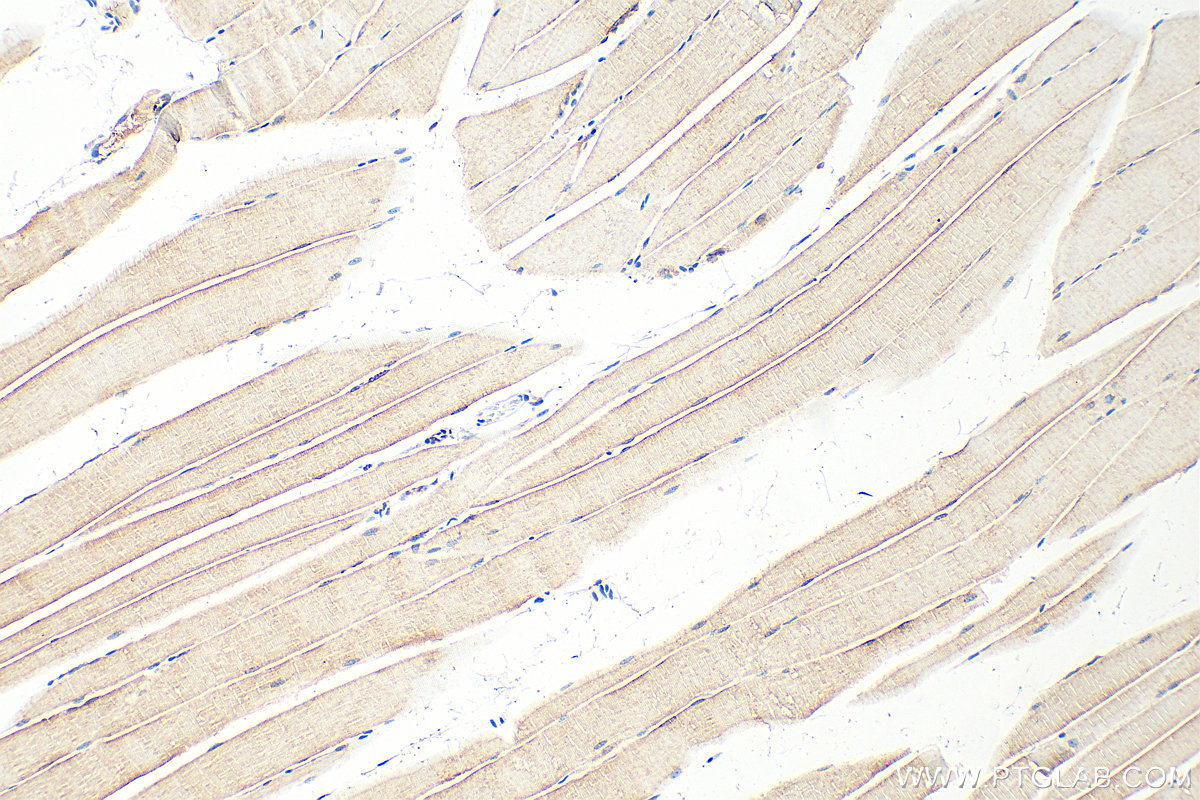 Immunohistochemistry (IHC) staining of mouse skeletal muscle tissue using MAP7D1 Polyclonal antibody (20788-1-AP)