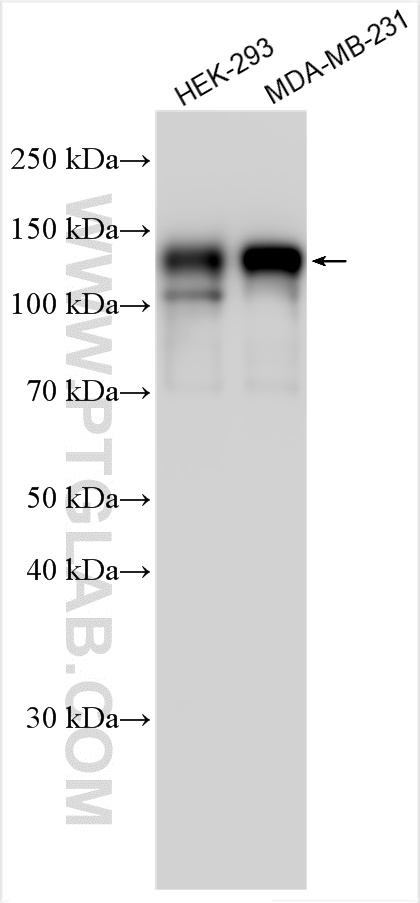 Western Blot (WB) analysis of various lysates using MAP7D1 Polyclonal antibody (20788-1-AP)