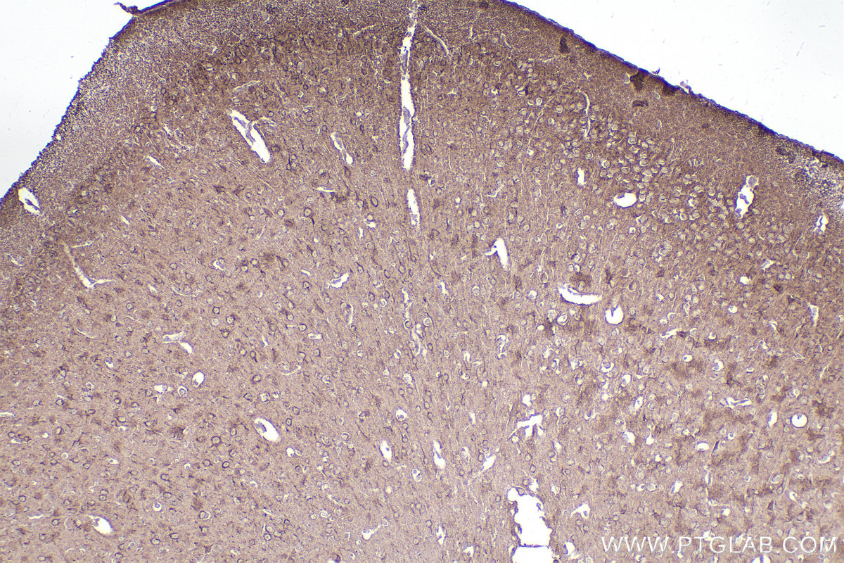 Immunohistochemistry (IHC) staining of mouse brain tissue using MAP9 Polyclonal antibody (26078-1-AP)