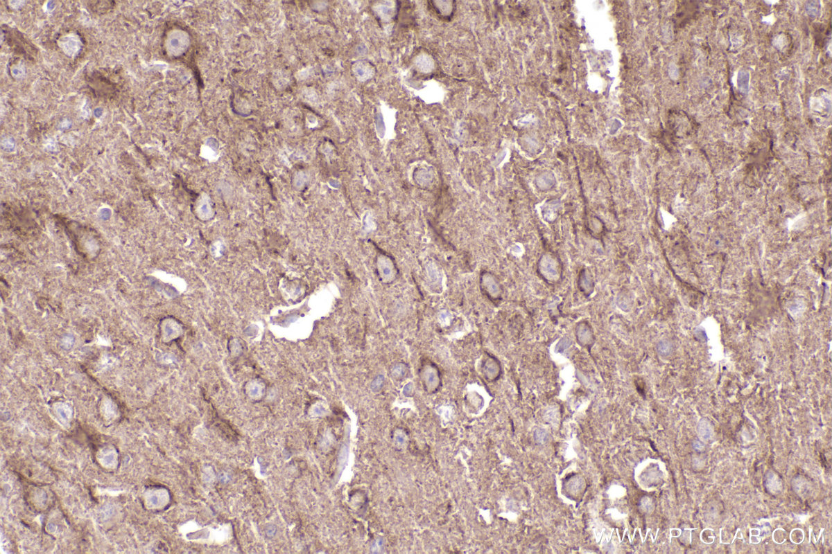 Immunohistochemistry (IHC) staining of mouse brain tissue using MAP9 Polyclonal antibody (26078-1-AP)