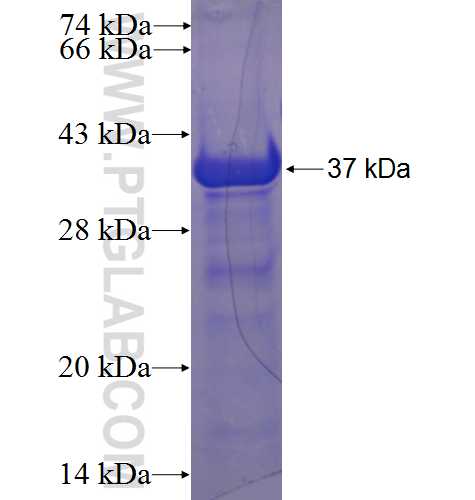 MAPK4 fusion protein Ag22999 SDS-PAGE