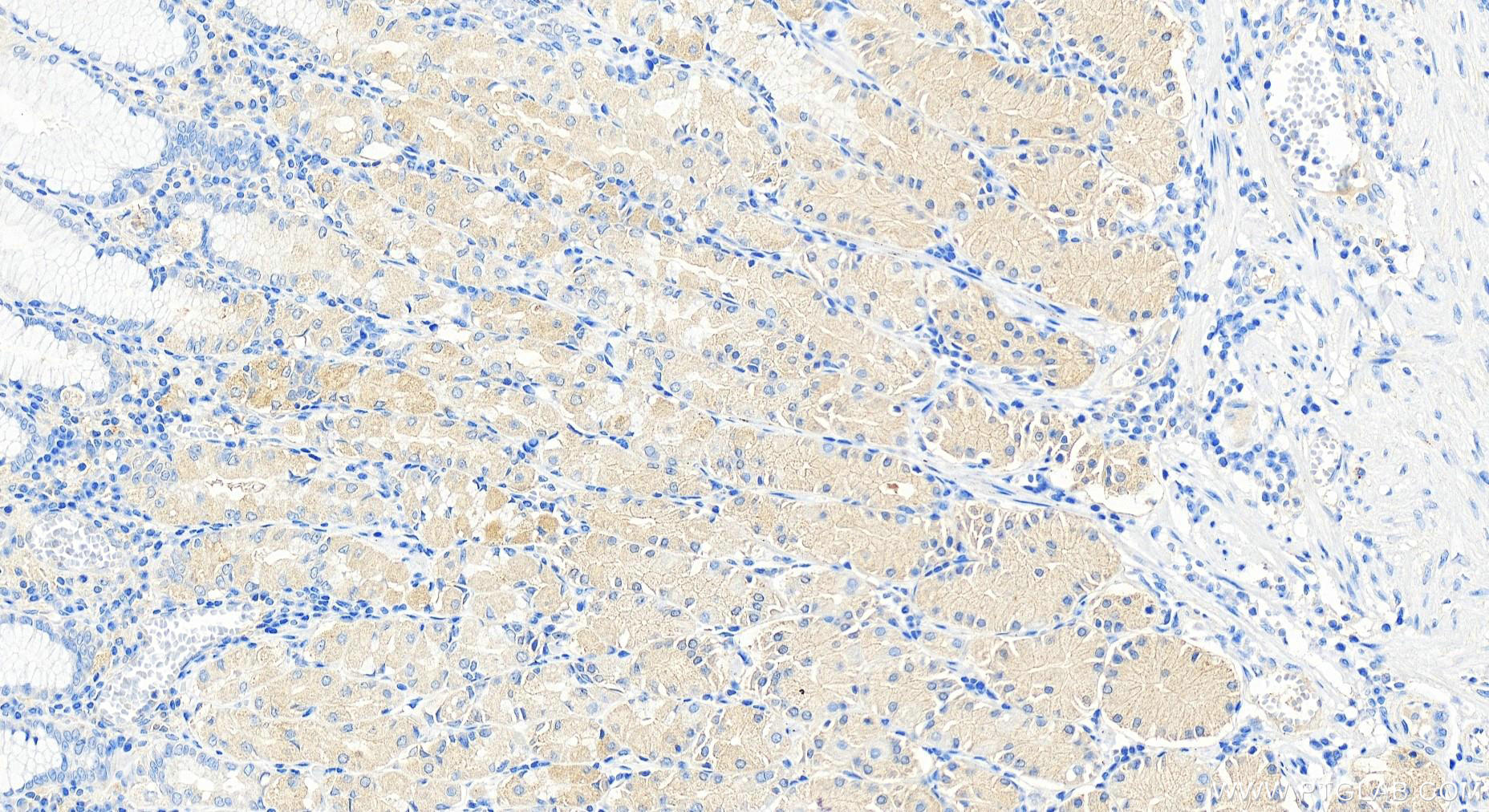 Immunohistochemistry (IHC) staining of human stomach tissue using ERK5 Polyclonal antibody (11164-1-AP)