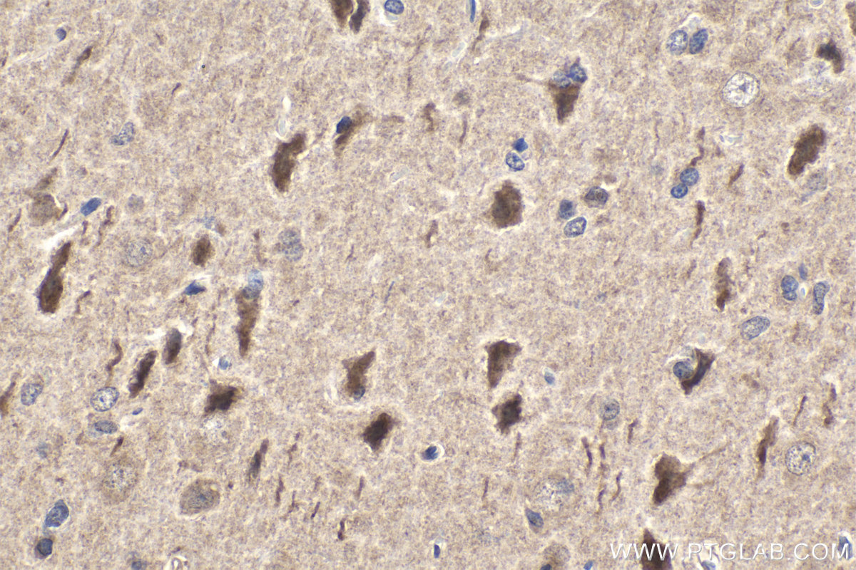 Immunohistochemistry (IHC) staining of rat brain tissue using JNK Polyclonal antibody (17337-1-AP)
