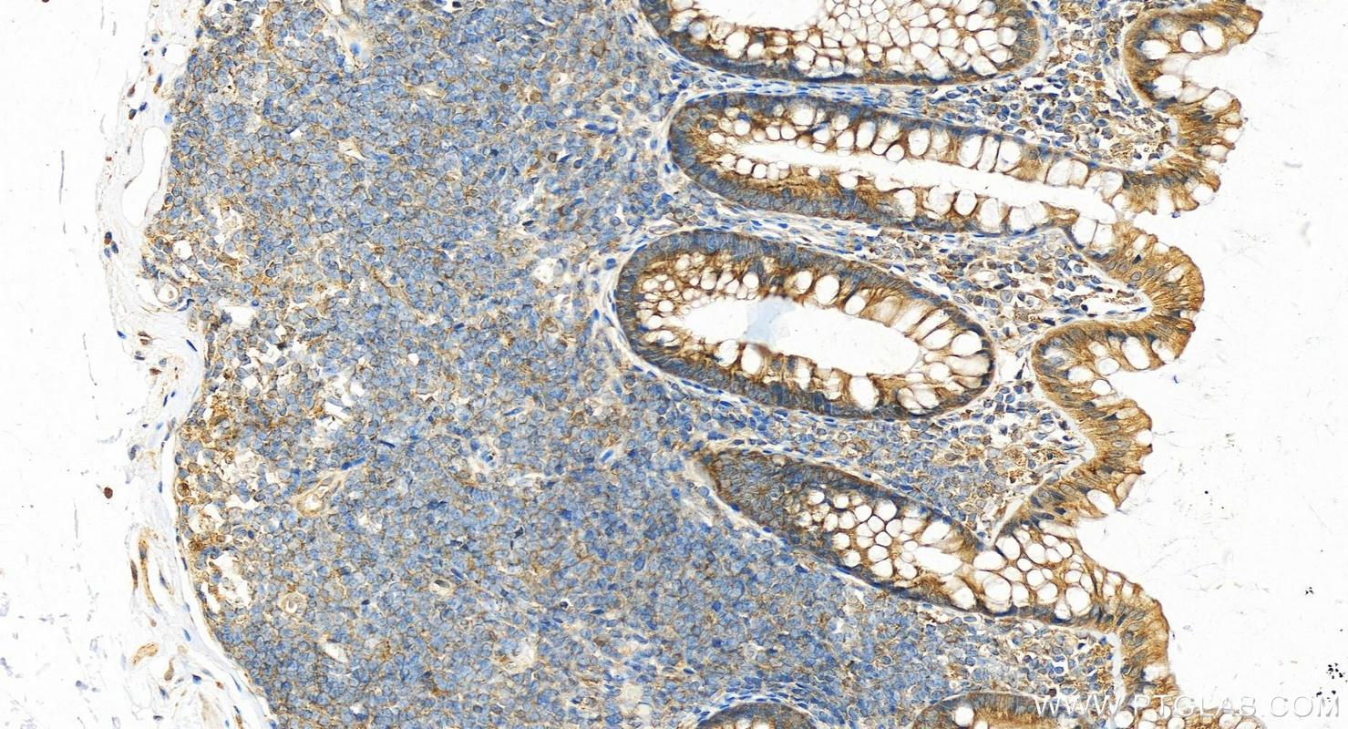 Immunohistochemistry (IHC) staining of human colon tissue using EB1 Polyclonal antibody (17717-1-AP)