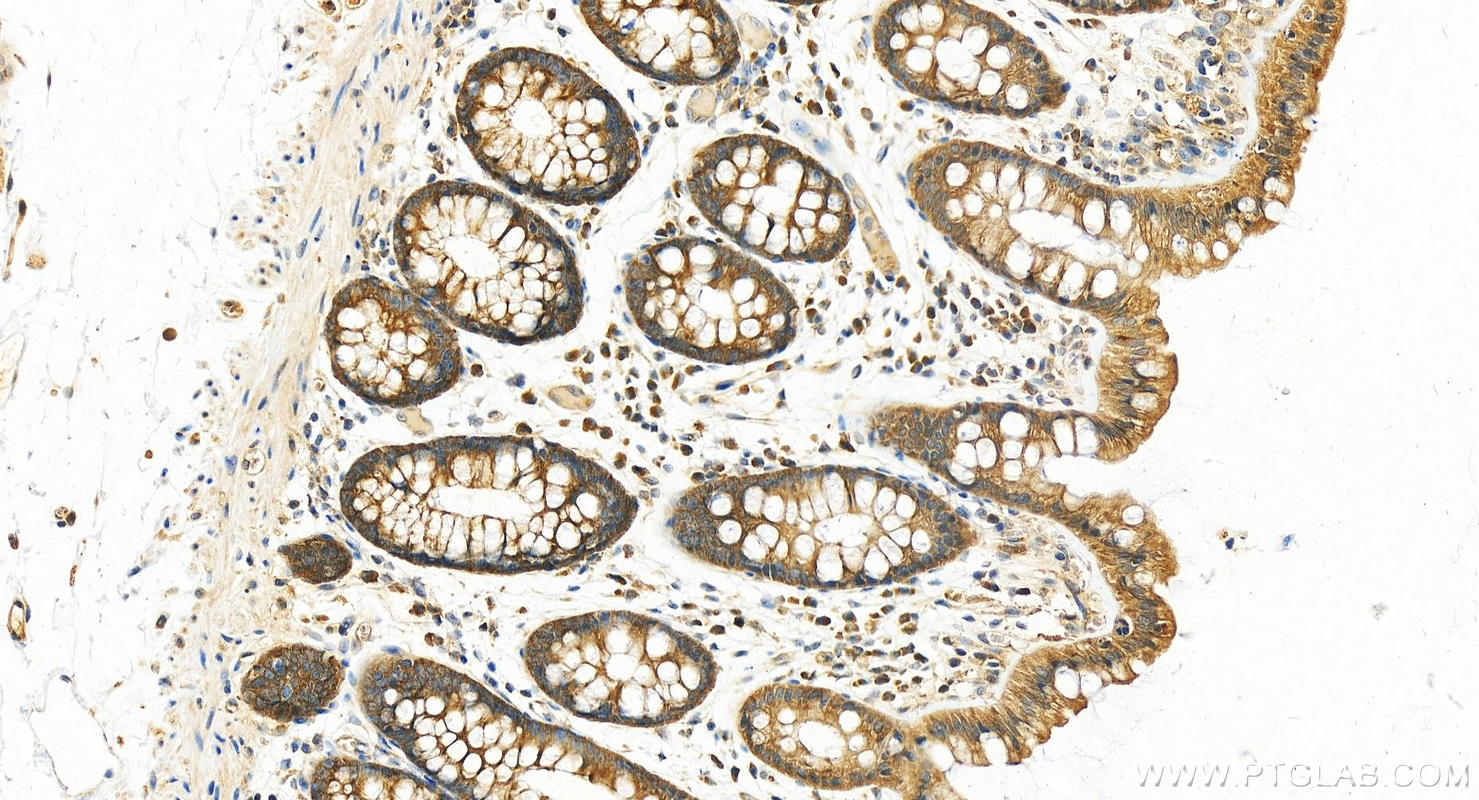 Immunohistochemistry (IHC) staining of human colon tissue using EB1 Polyclonal antibody (17717-1-AP)