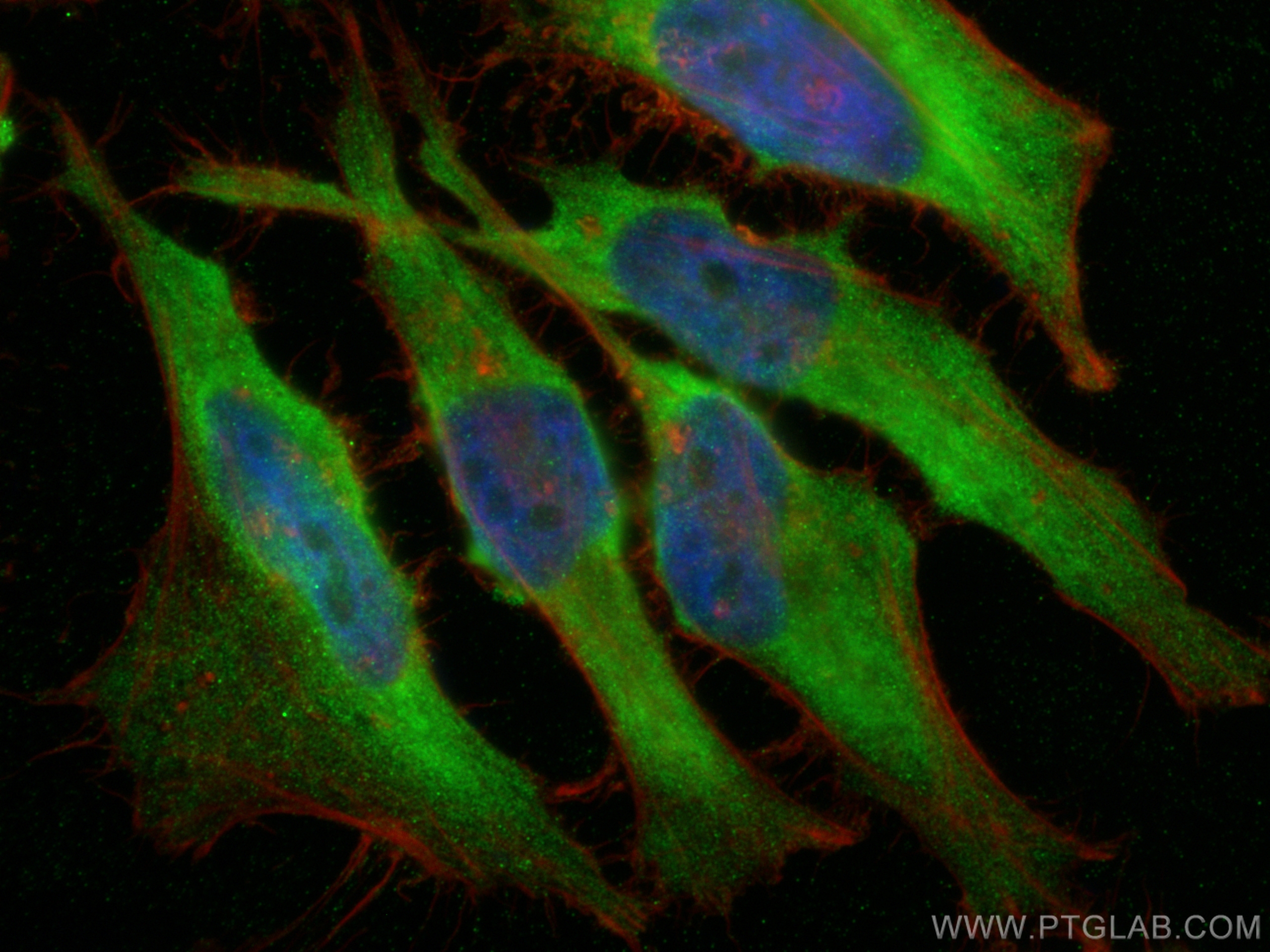 Immunofluorescence (IF) / fluorescent staining of HeLa cells using EB1 Polyclonal antibody (17717-1-AP)