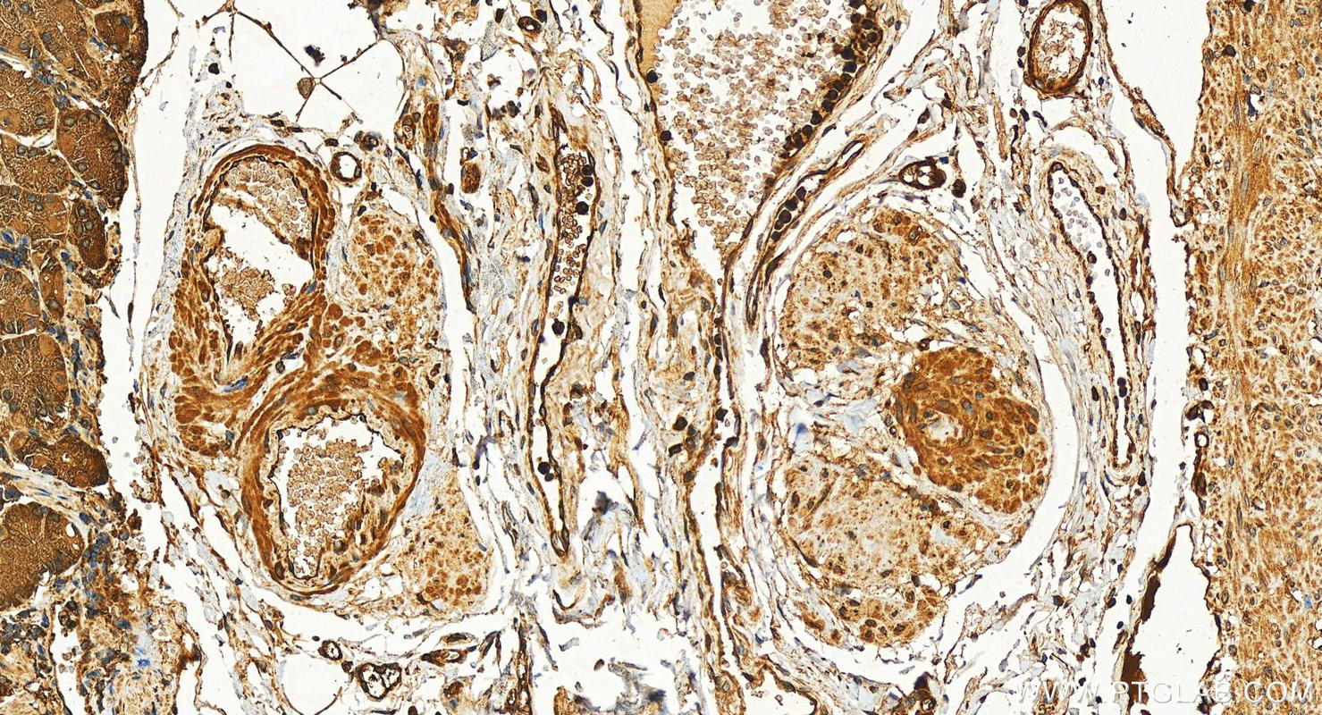 Immunohistochemistry (IHC) staining of human stomach tissue using MAPRE2 Polyclonal antibody (10364-1-AP)