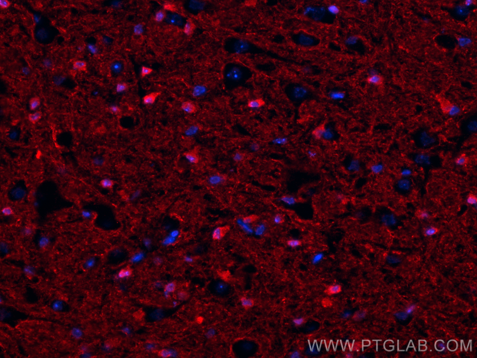 Immunofluorescence (IF) / fluorescent staining of mouse brain tissue using TAU Polyclonal antibody (10274-1-AP)