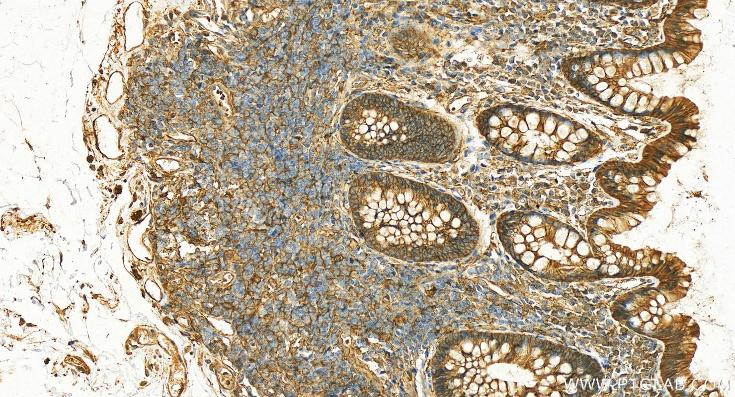 Immunohistochemistry (IHC) staining of human normal colon using MARCKS Polyclonal antibody (20661-1-AP)