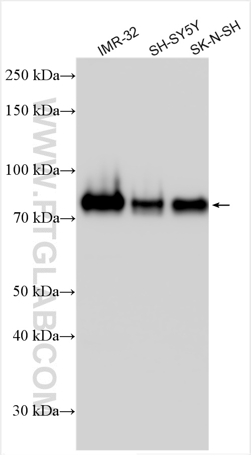 Western Blot (WB) analysis of various lysates using MARCKS Polyclonal antibody (20661-1-AP)