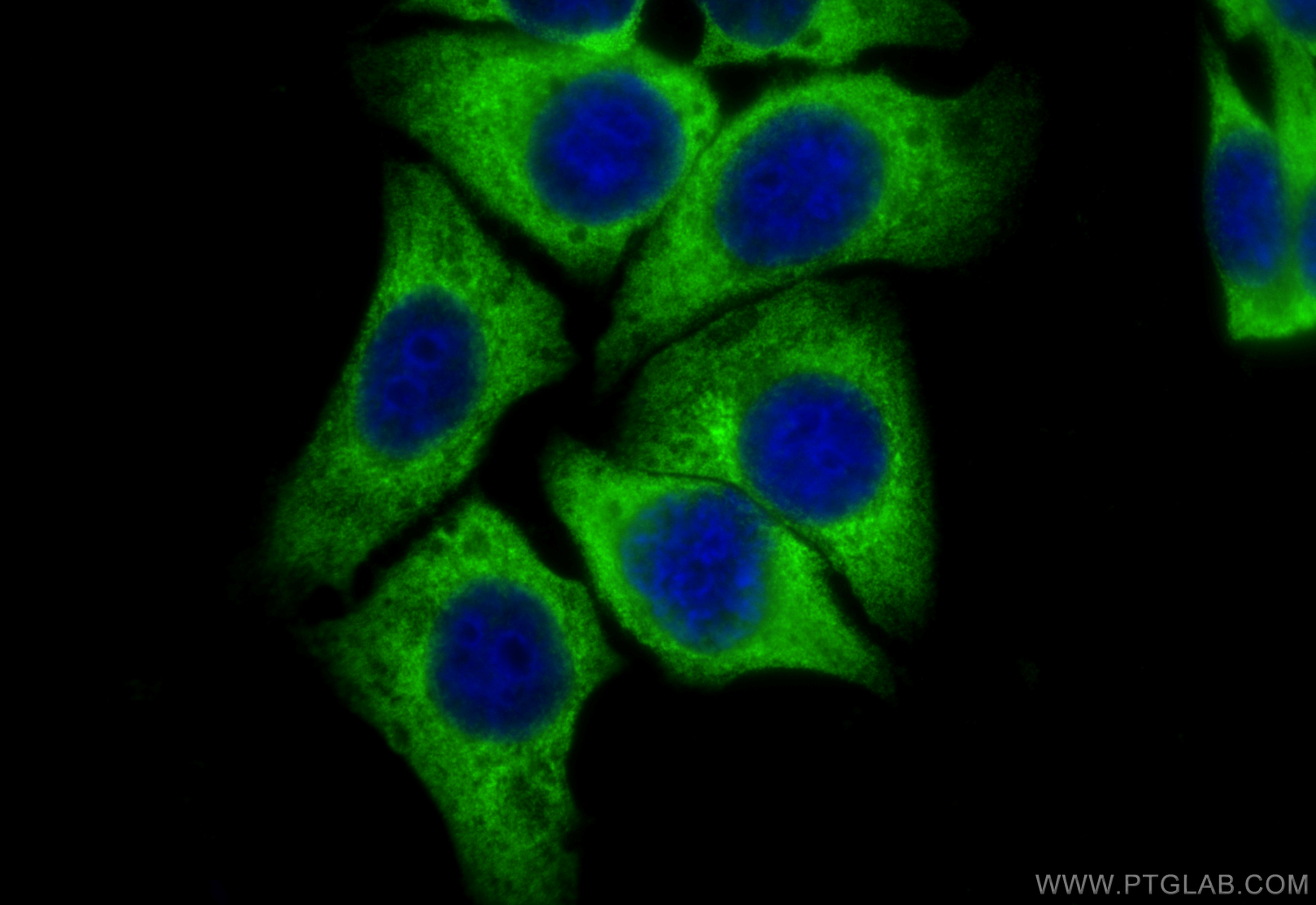 Immunofluorescence (IF) / fluorescent staining of HepG2 cells using MARS Polyclonal antibody (14829-1-AP)