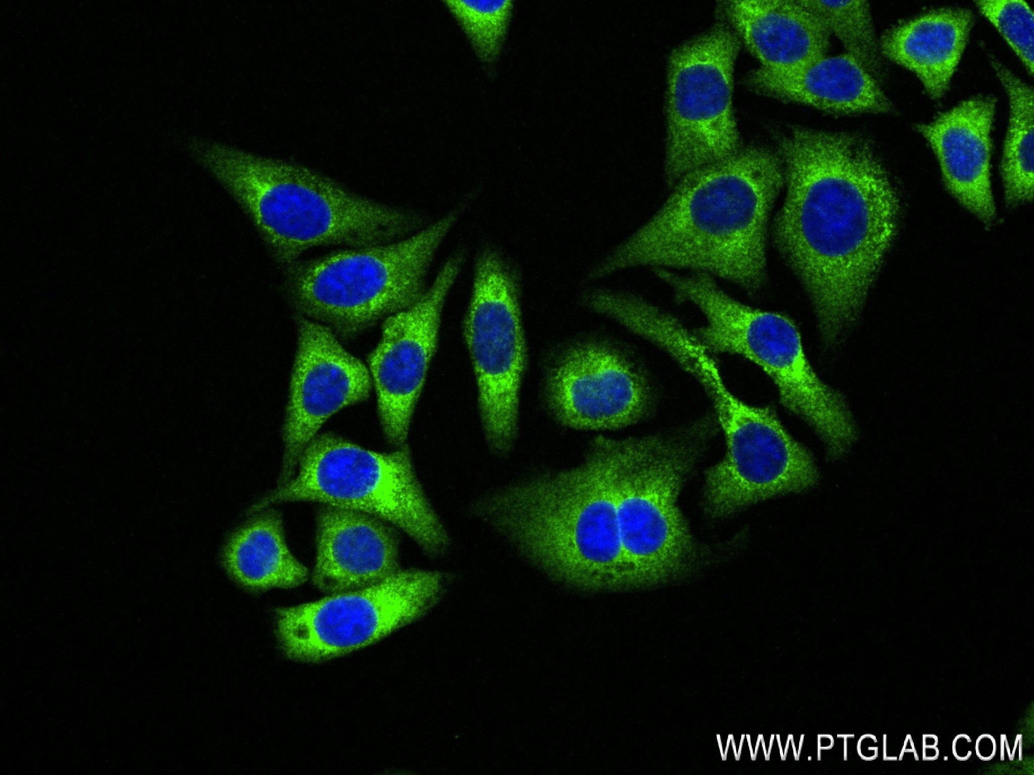 Immunofluorescence (IF) / fluorescent staining of HepG2 cells using MARS Recombinant antibody (83690-4-RR)