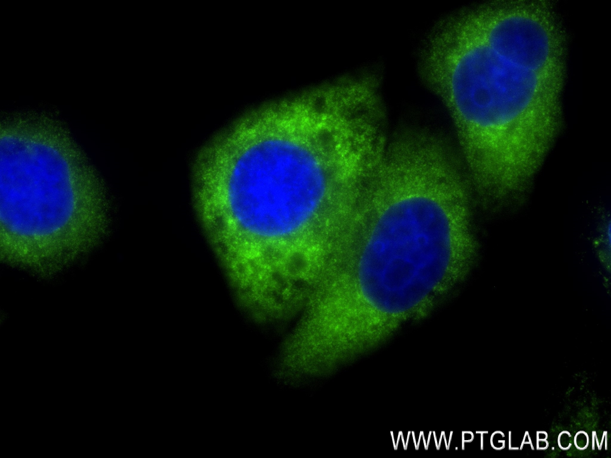 Immunofluorescence (IF) / fluorescent staining of HepG2 cells using MARS Recombinant antibody (83690-4-RR)