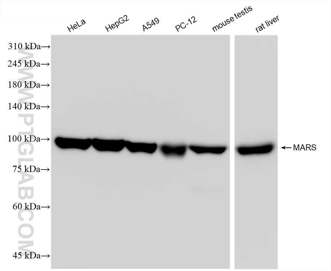 Western Blot (WB) analysis of various lysates using MARS Recombinant antibody (83690-4-RR)