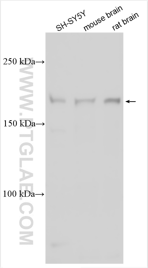 Western Blot (WB) analysis of various lysates using MAST1 Polyclonal antibody (13305-1-AP)