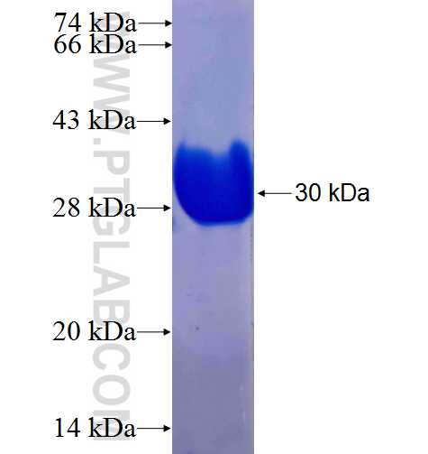 MAST4 fusion protein Ag24423 SDS-PAGE