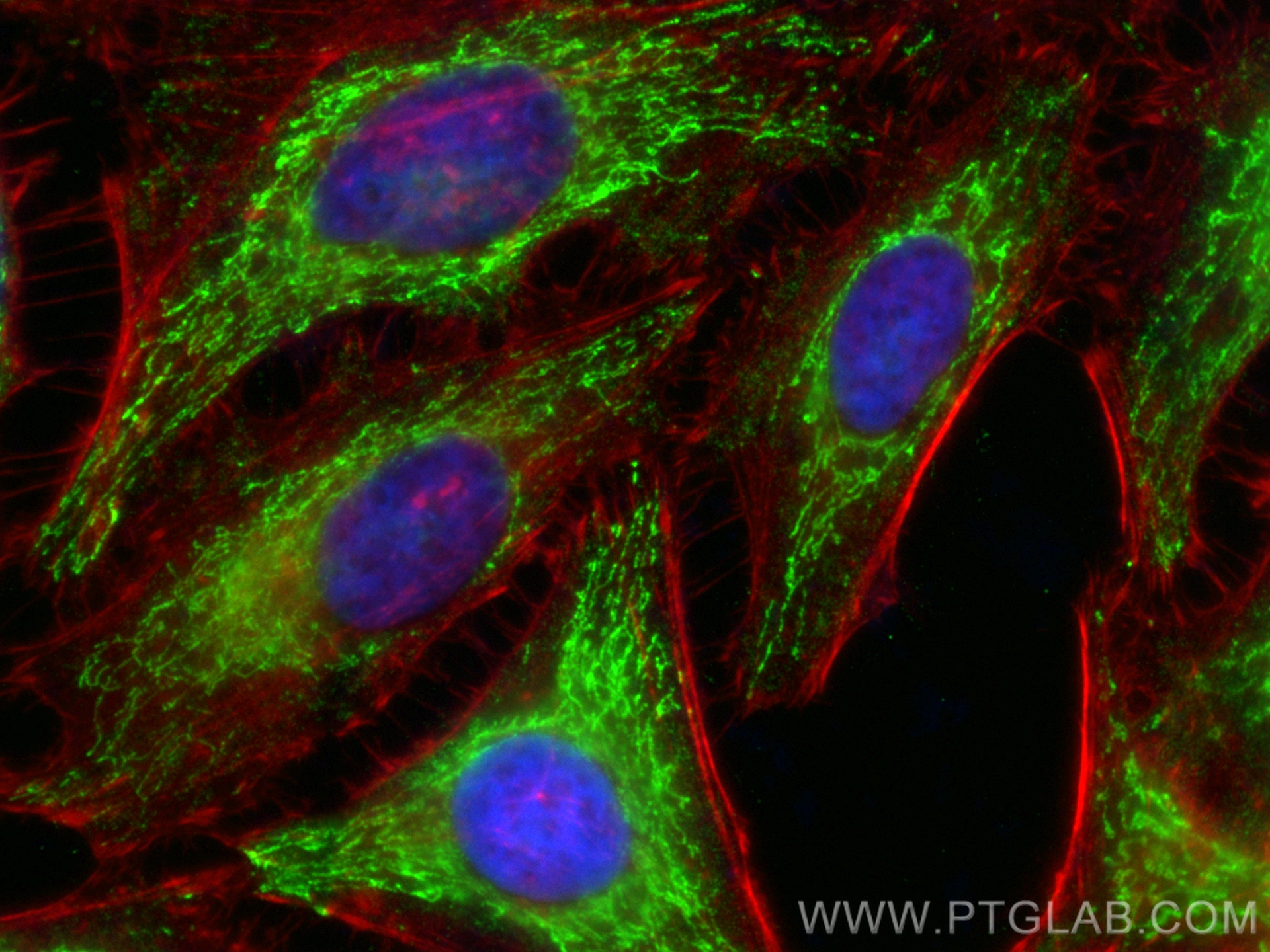 Immunofluorescence (IF) / fluorescent staining of HeLa cells using CoraLite® Plus 488-conjugated MAT1A Monoclonal ant (CL488-67408)