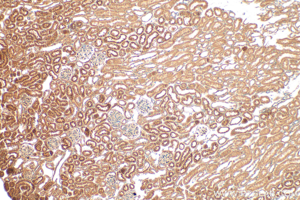Immunohistochemistry (IHC) staining of mouse kidney tissue using Matrilin 2 Polyclonal antibody (24064-1-AP)