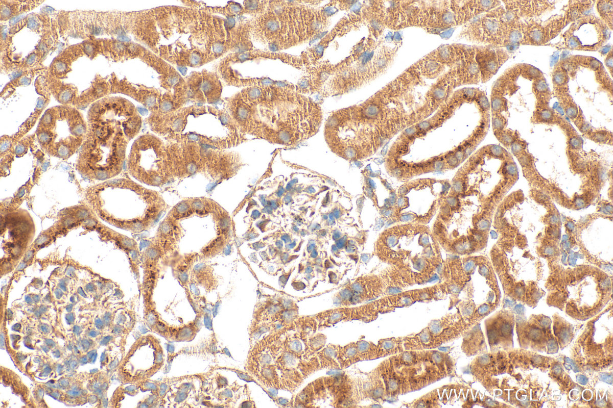 Immunohistochemistry (IHC) staining of mouse kidney tissue using Matrilin 2 Polyclonal antibody (24064-1-AP)