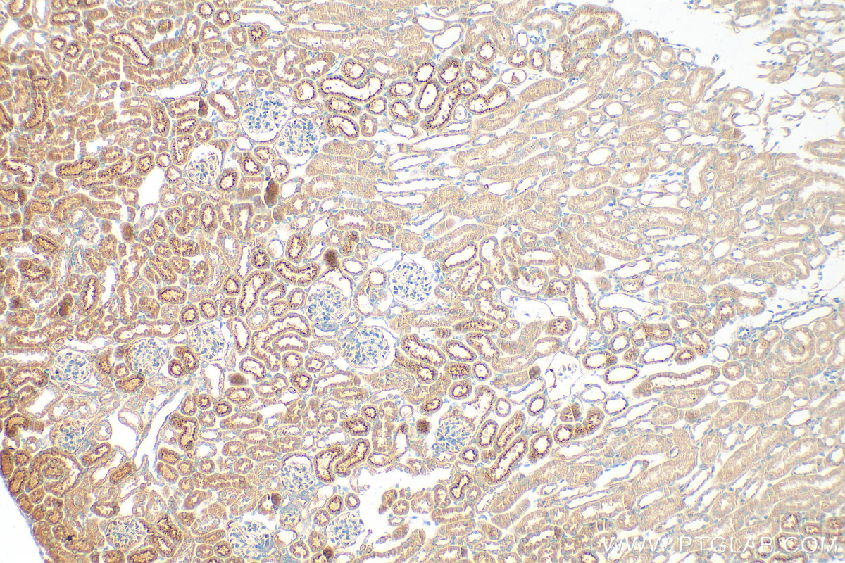 Immunohistochemistry (IHC) staining of mouse kidney tissue using Matrilin 2 Polyclonal antibody (24064-1-AP)