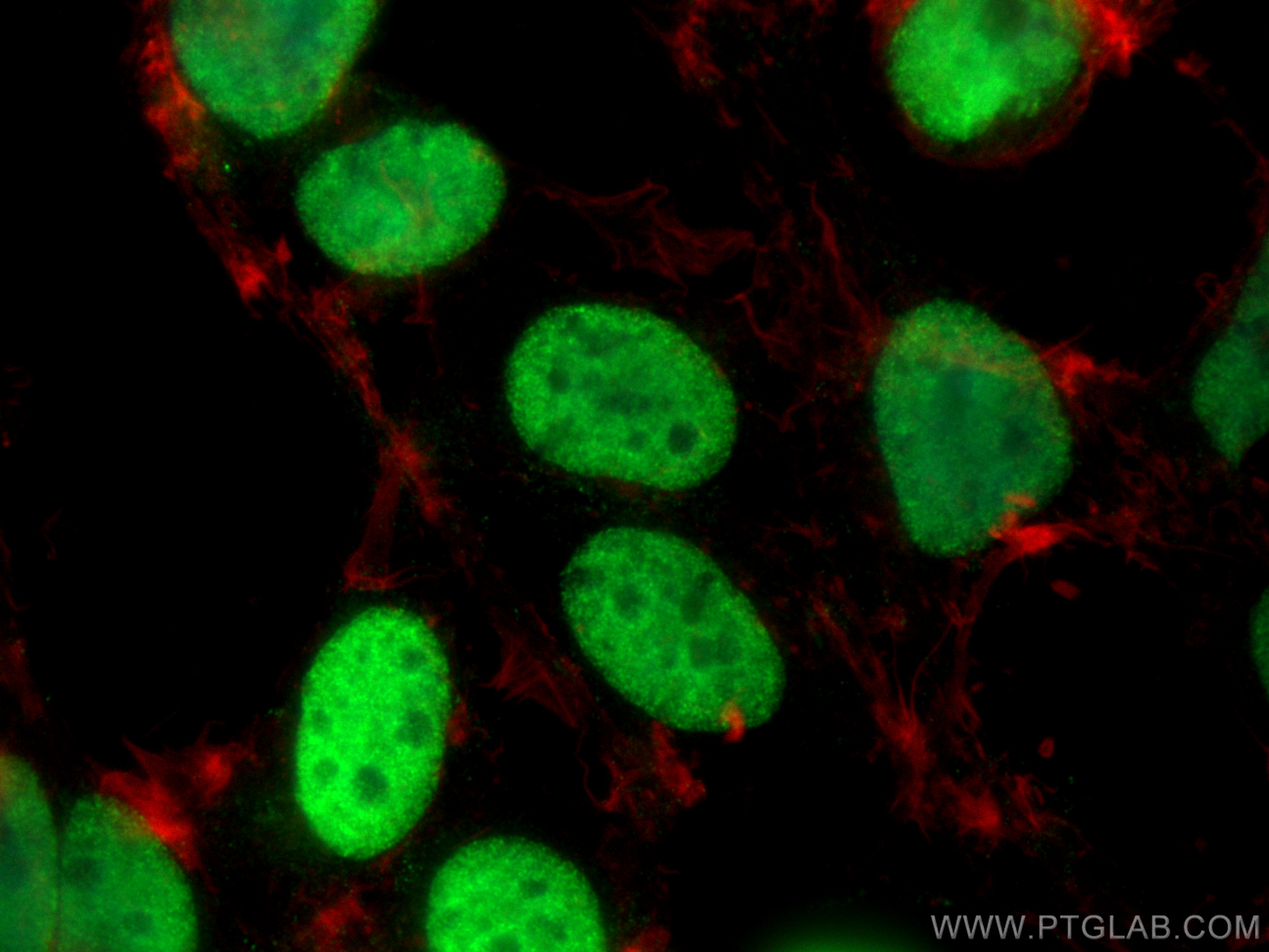 Immunofluorescence (IF) / fluorescent staining of HEK-293 cells using MATR3 Polyclonal antibody (12202-2-AP)