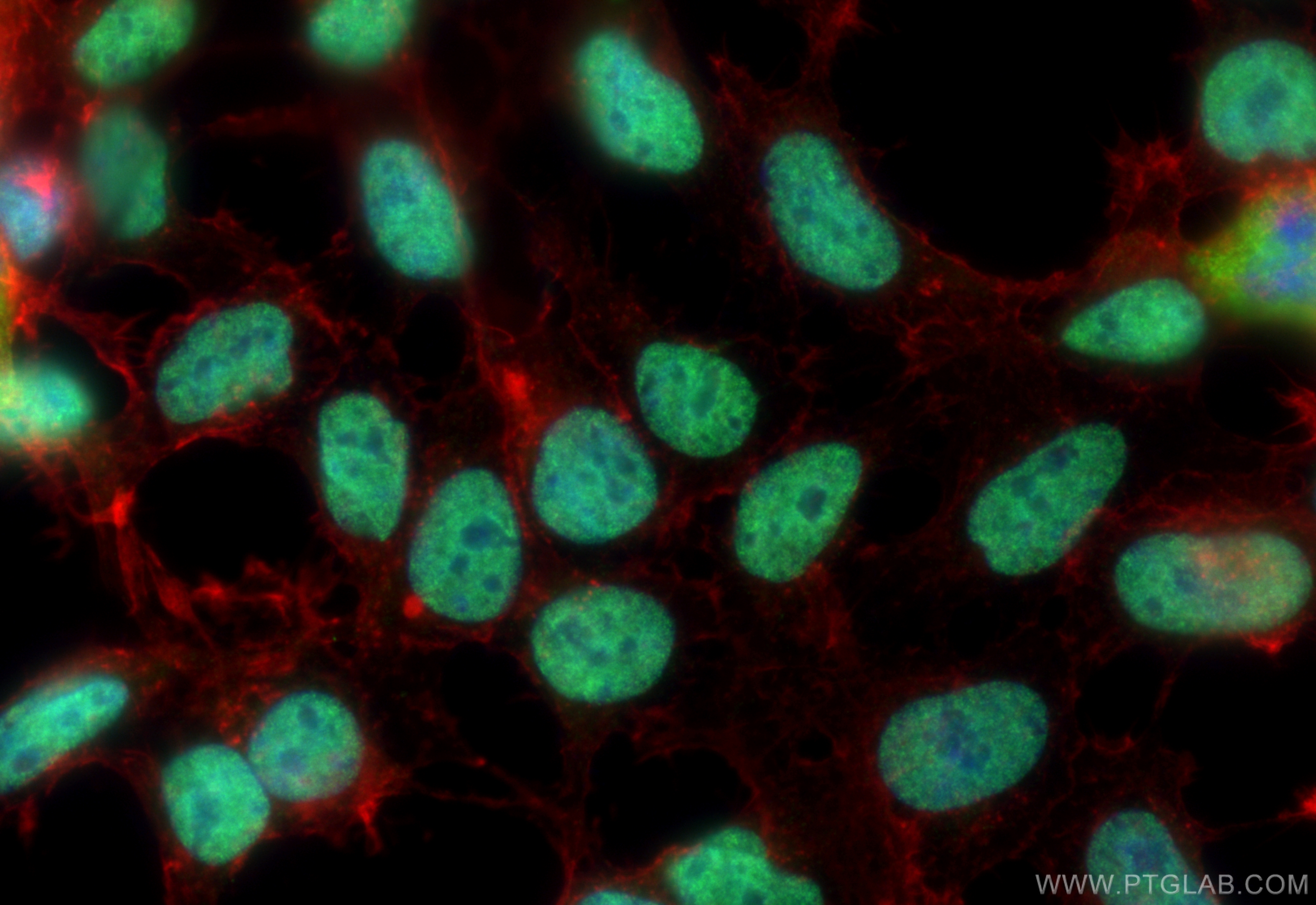 Immunofluorescence (IF) / fluorescent staining of HEK-293 cells using MATR3 Monoclonal antibody (68280-1-Ig)