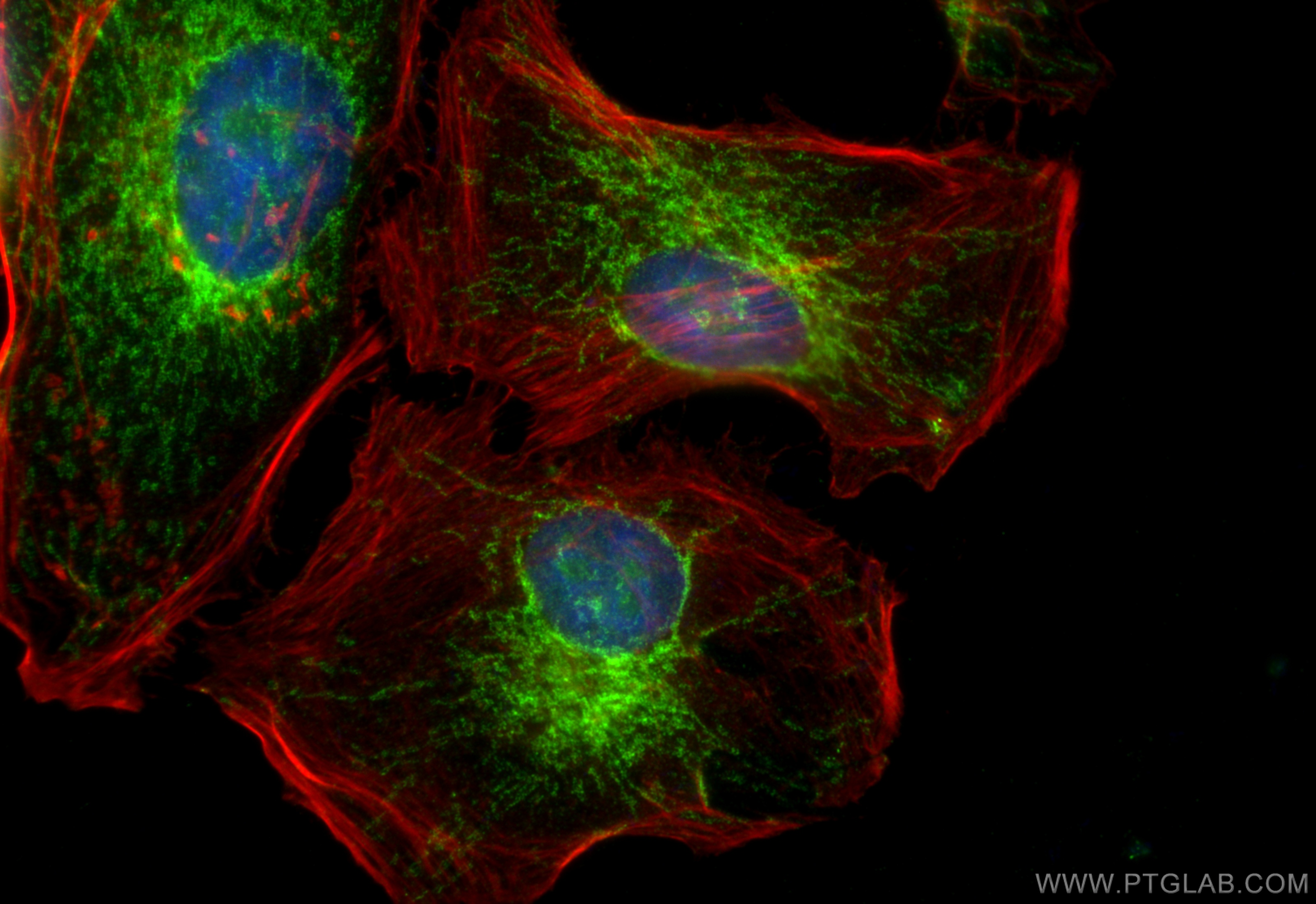 Immunofluorescence (IF) / fluorescent staining of HeLa cells using MAVS; VISA Polyclonal antibody (14341-1-AP)